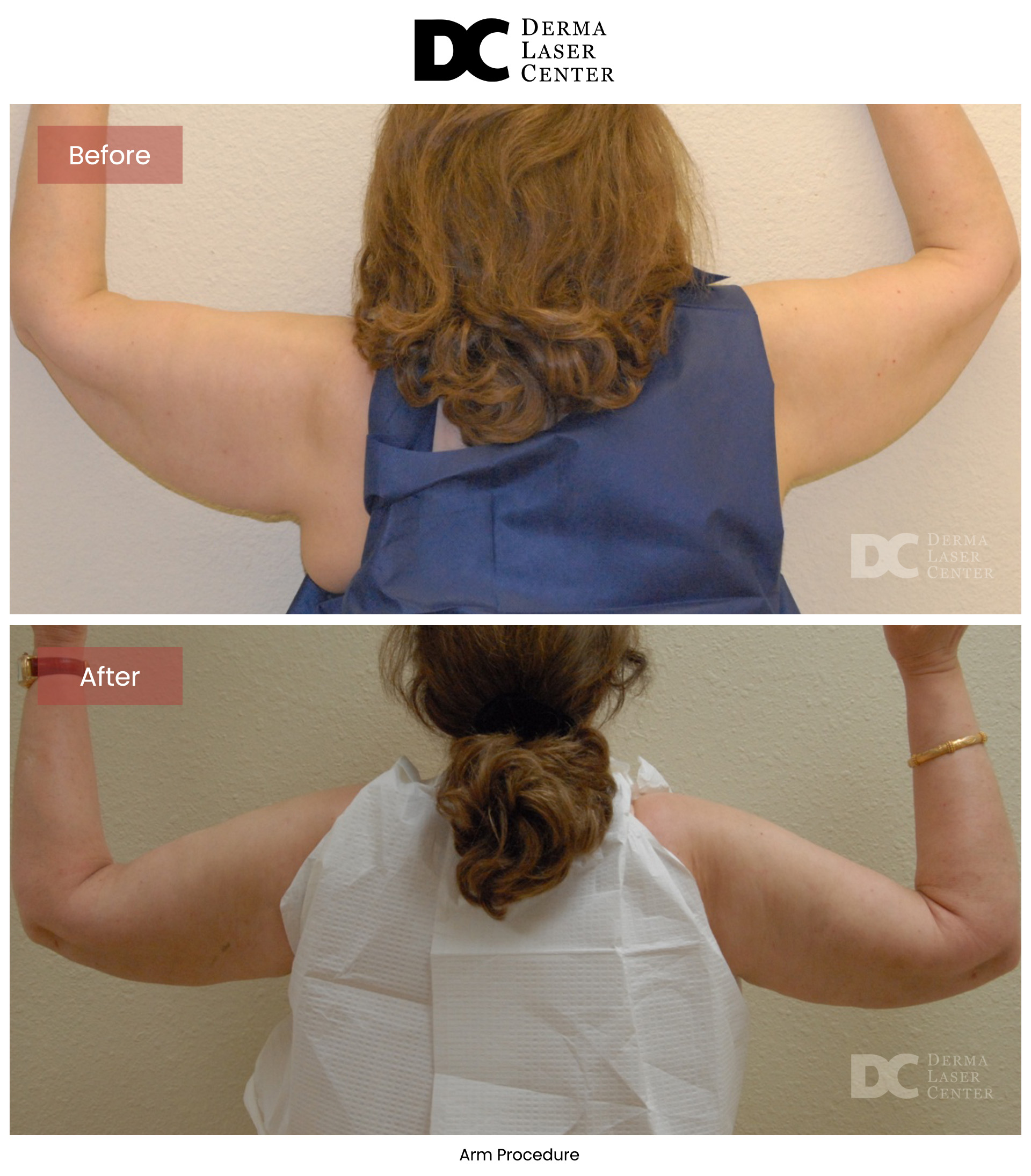 B&A Arms Image 52 V1