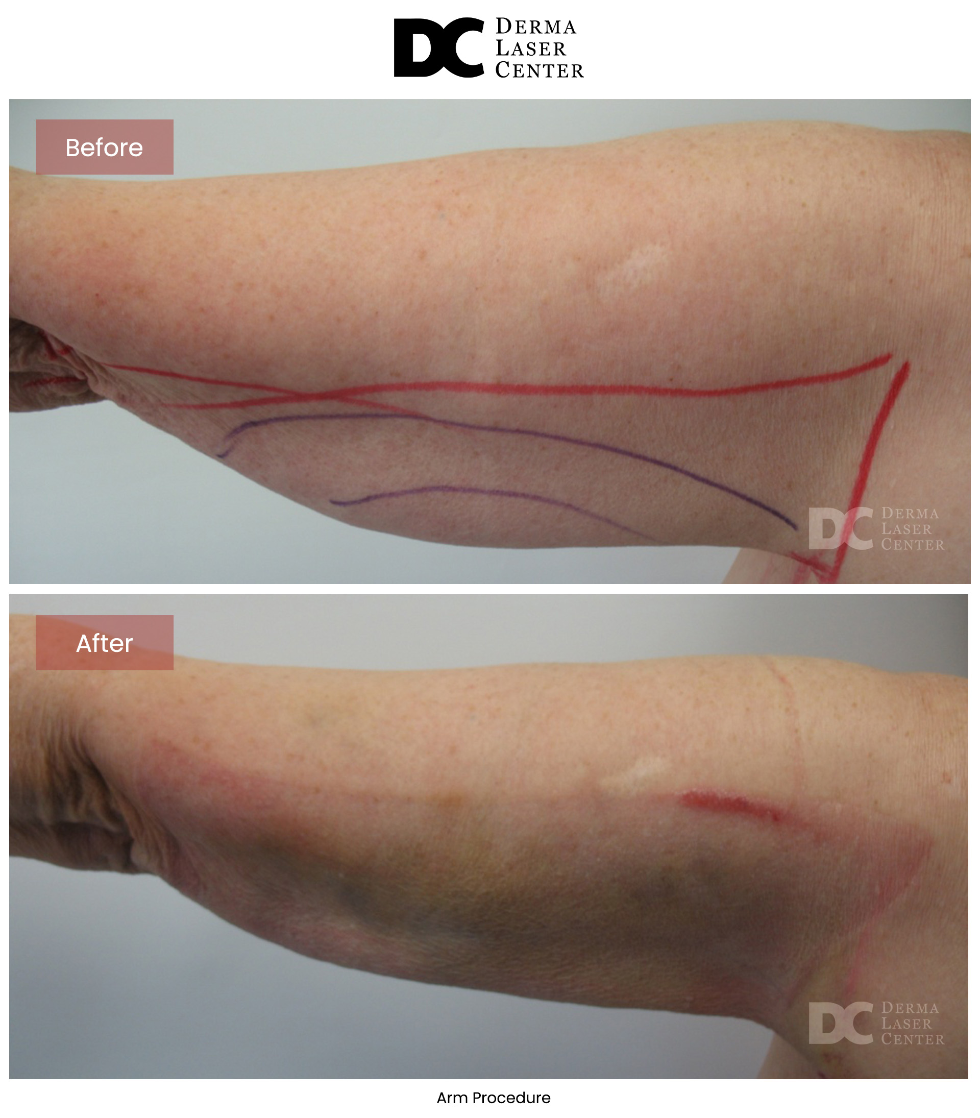 B&A Arms Image 56 V1