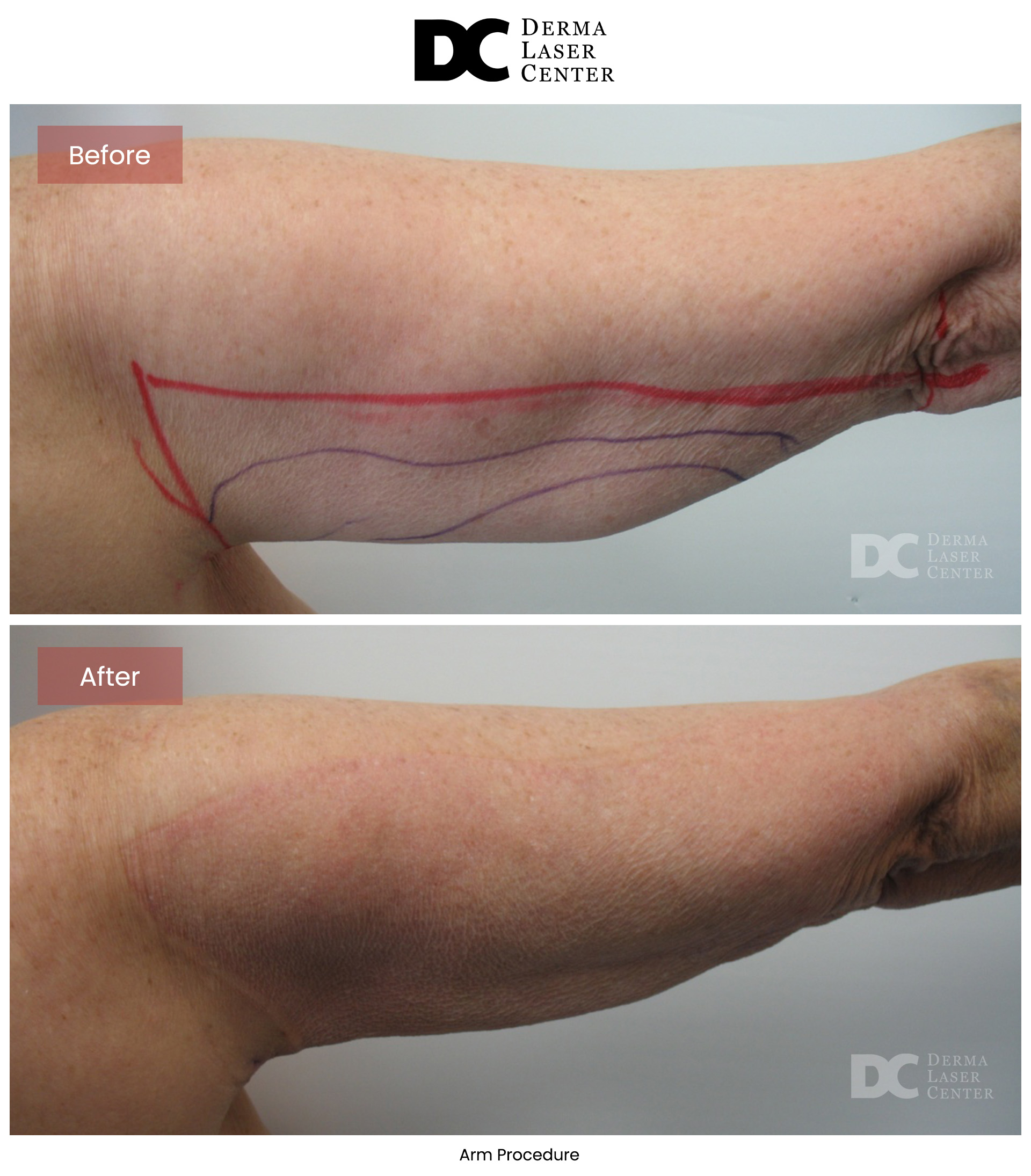 B&A Arms Image 57 V1