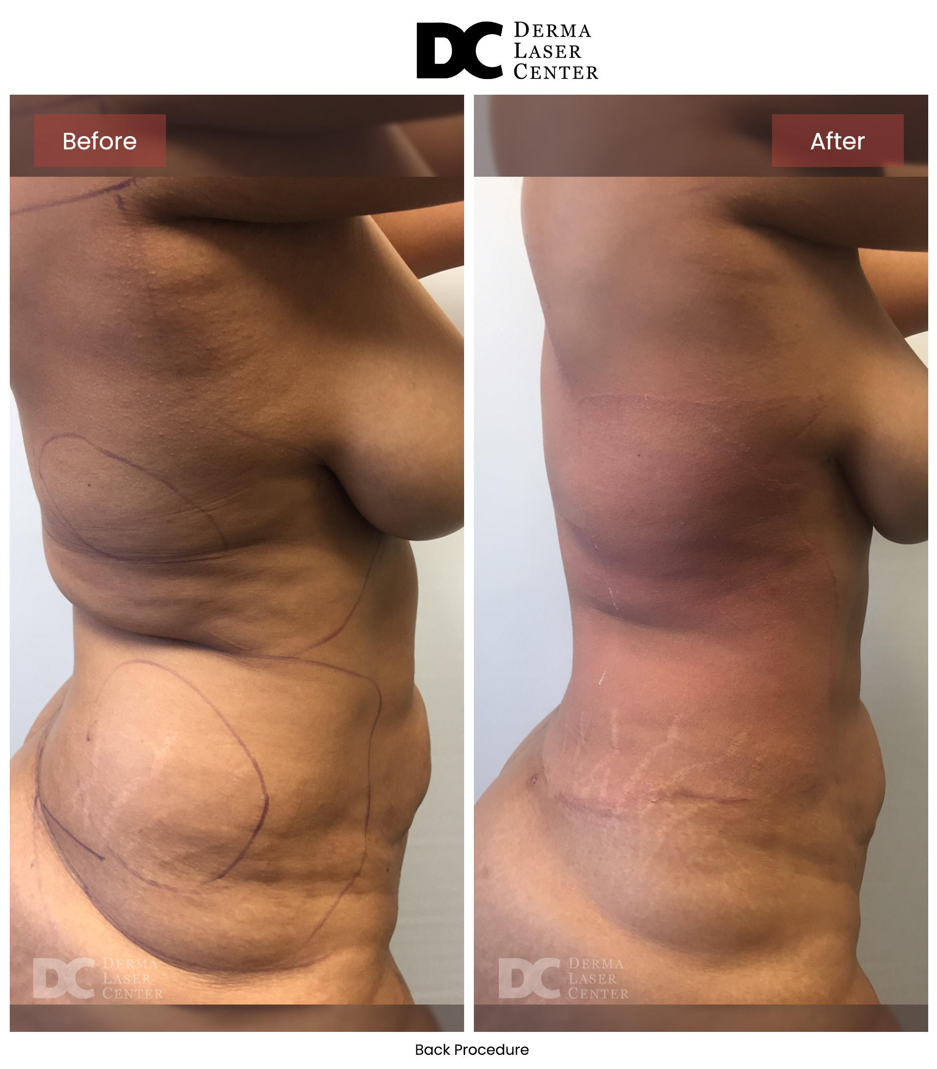 B&A Back Image 01 V1