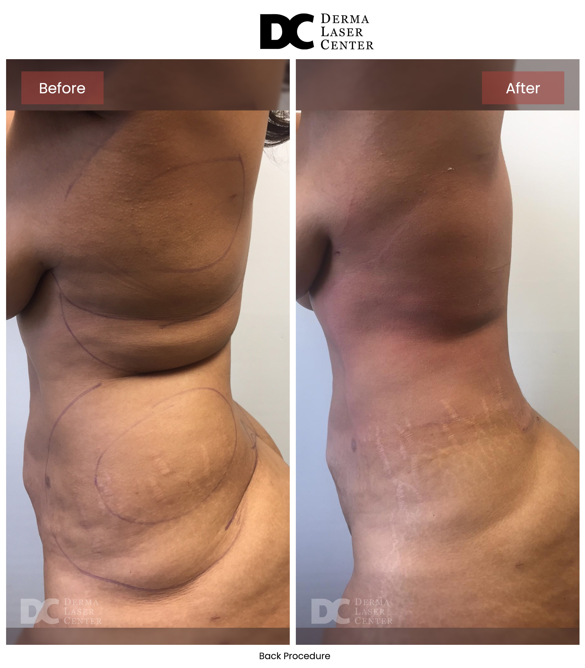 B&A Back Image 02 V1