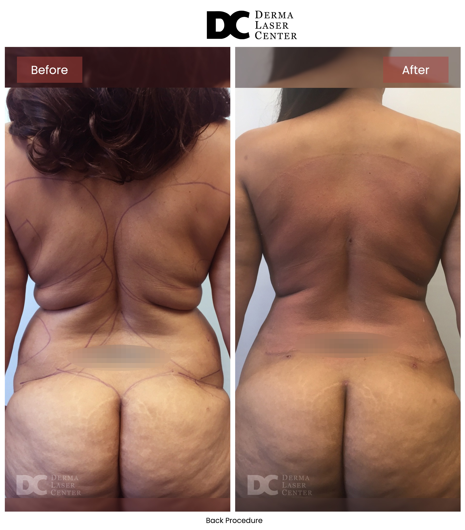 B&A Back Image 03 V1