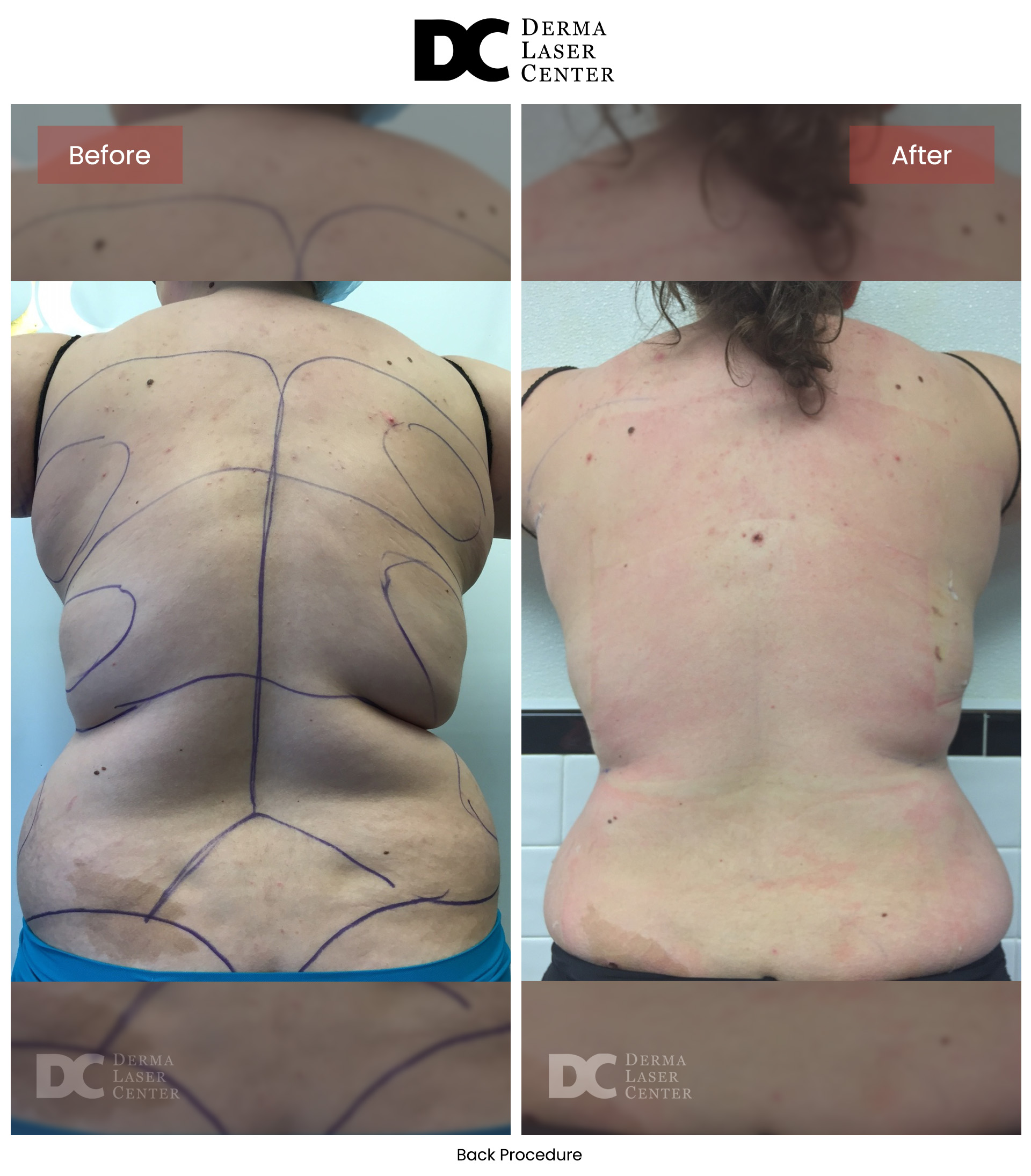 B&A Back Image 05 V1