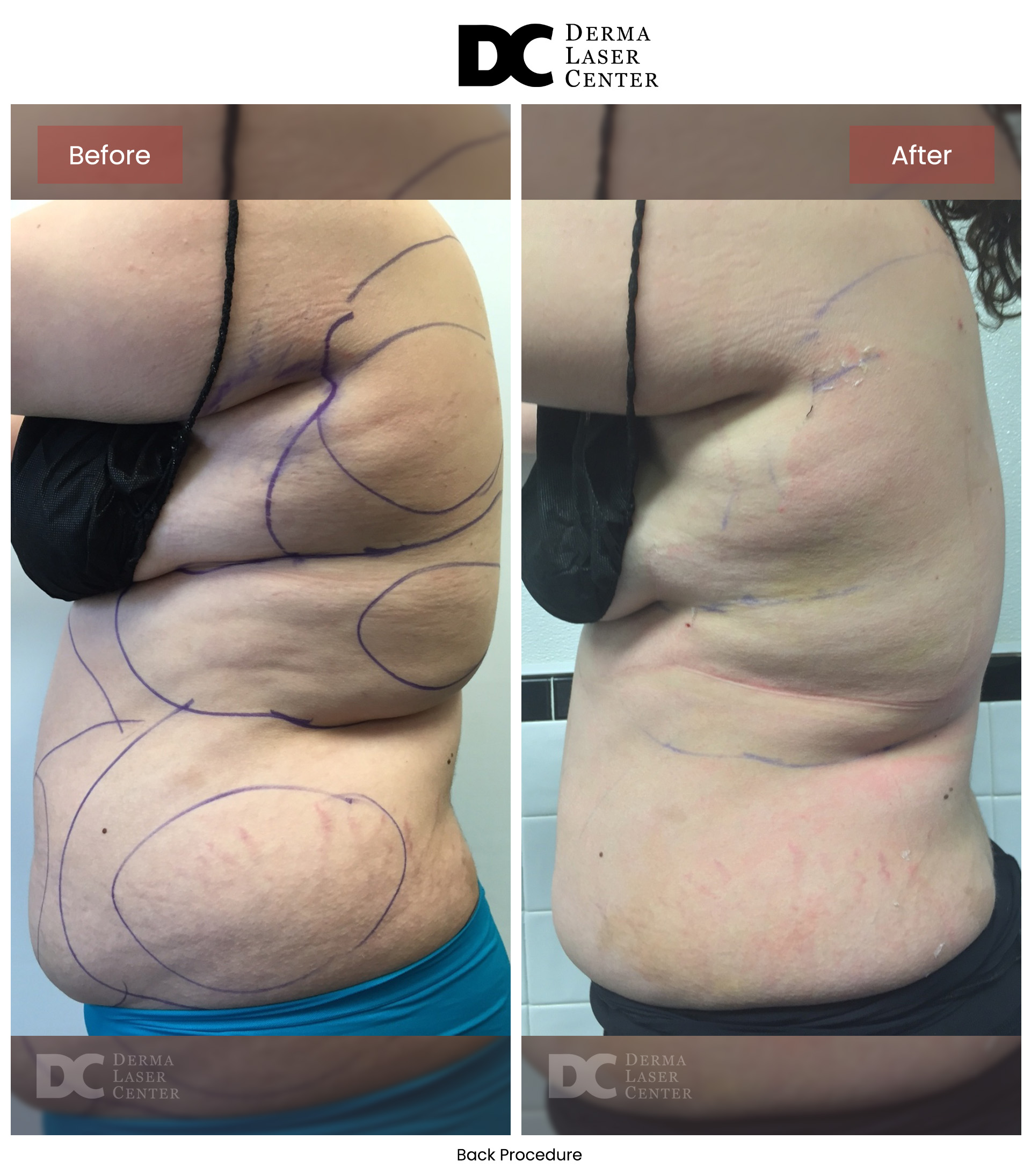 B&A Back Image 07 V1