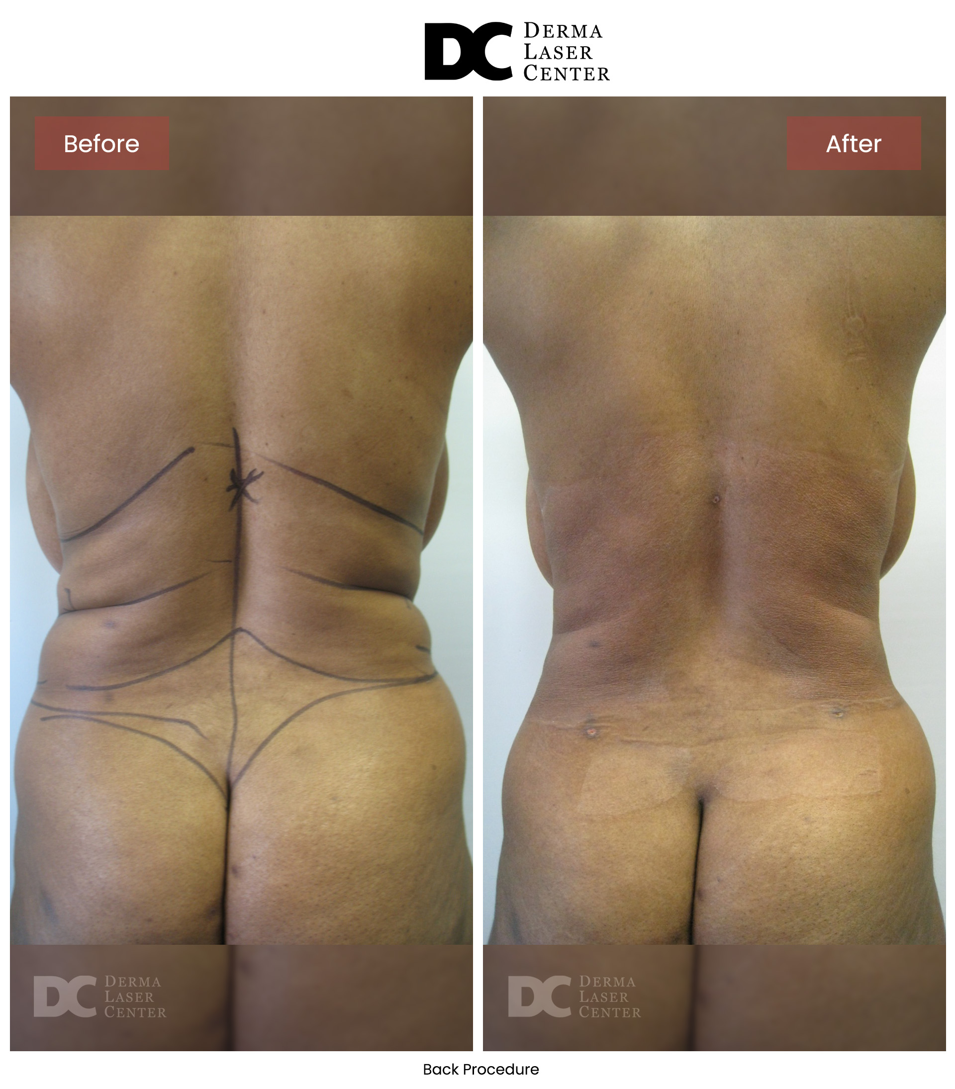 B&A Back Image 08 V1