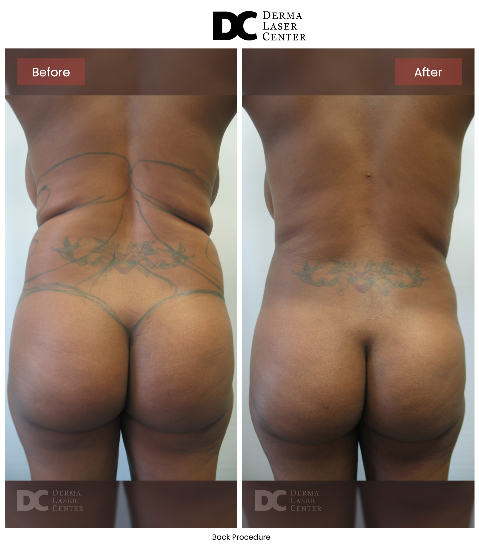 B&A Back Image 09 V1