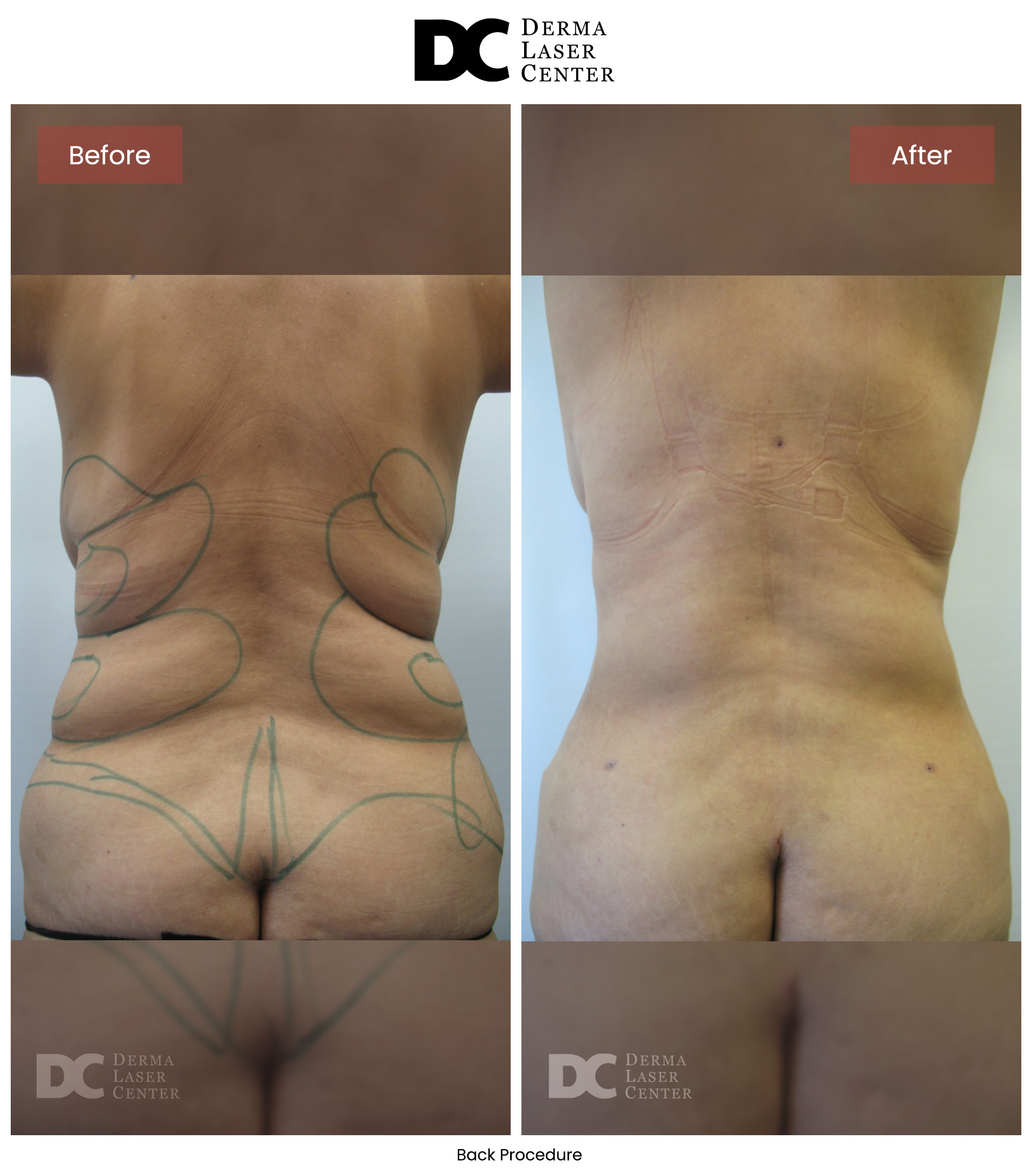 B&A Back Image 10 V1