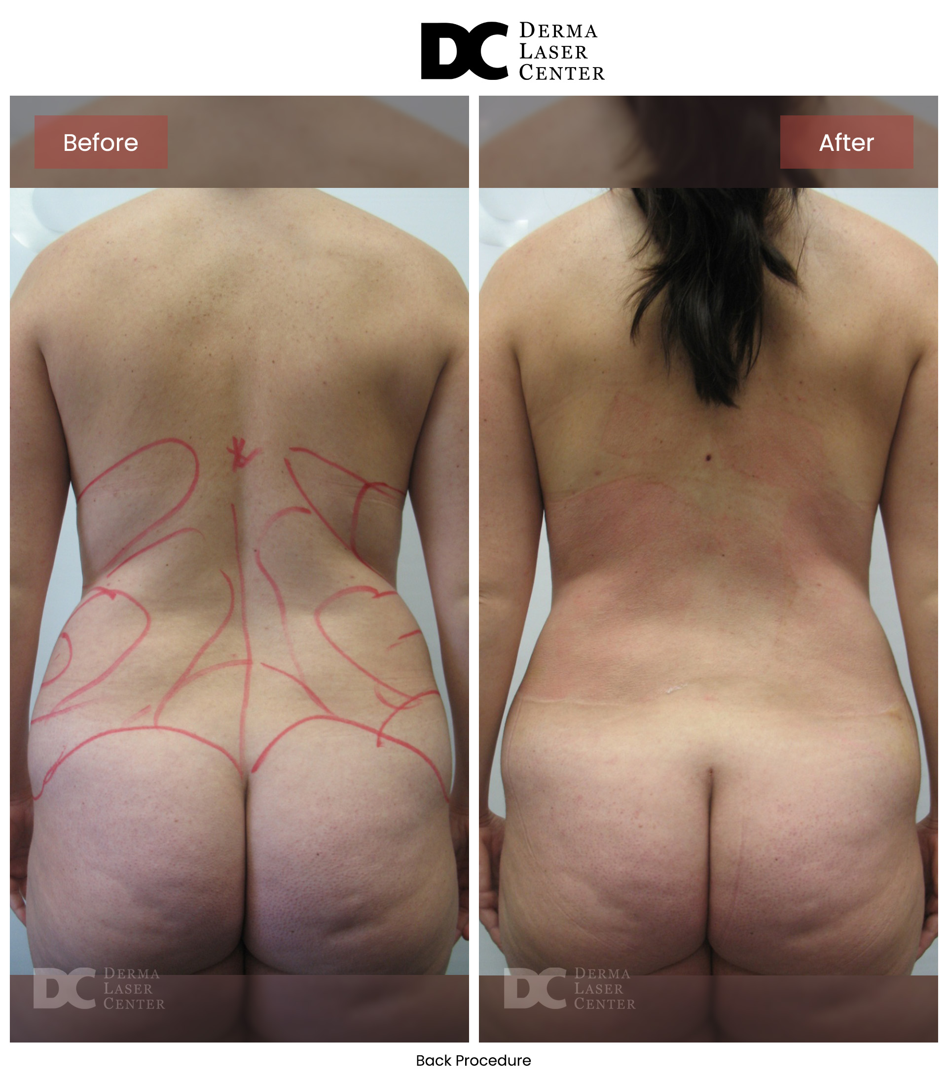 B&A Back Image 12 V1