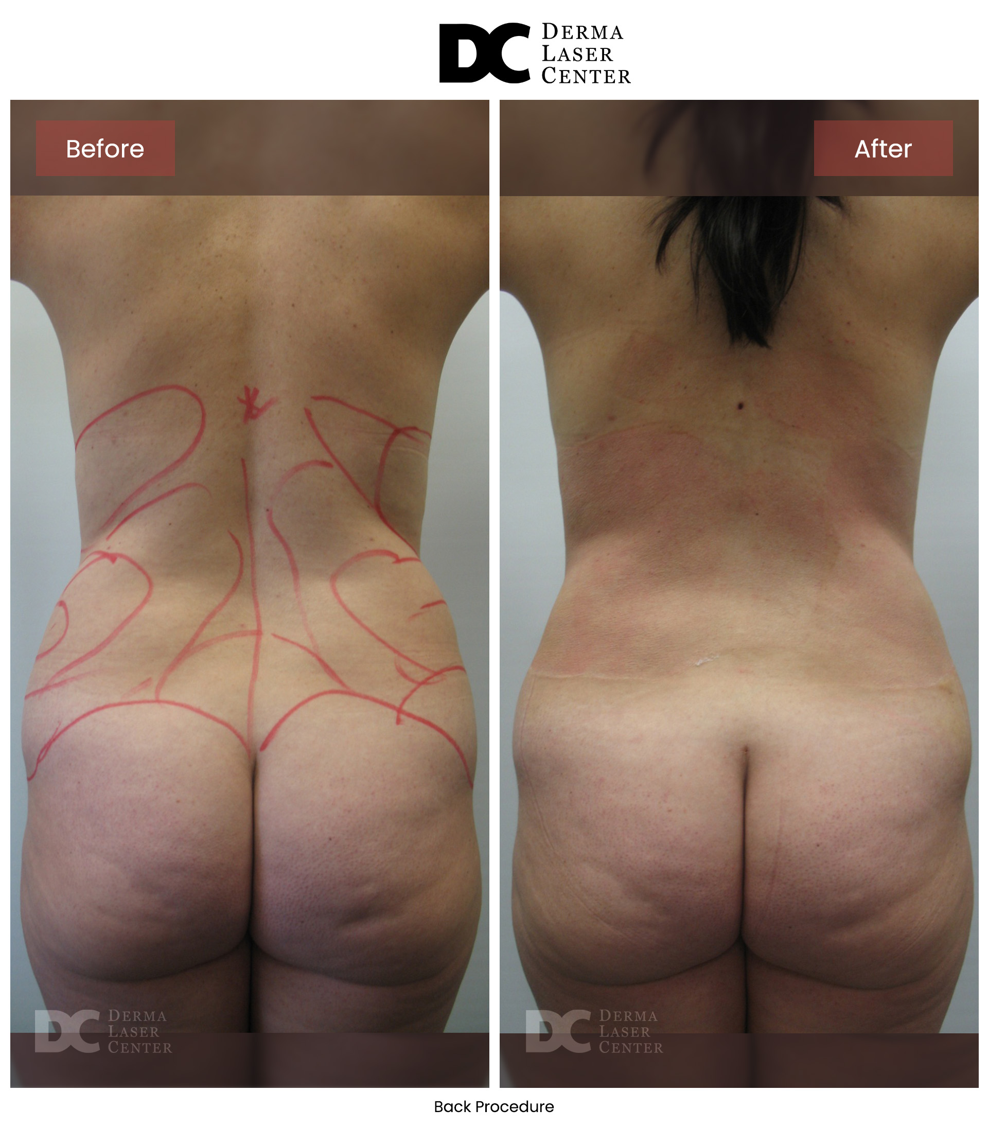 B&A Back Image 13 V1