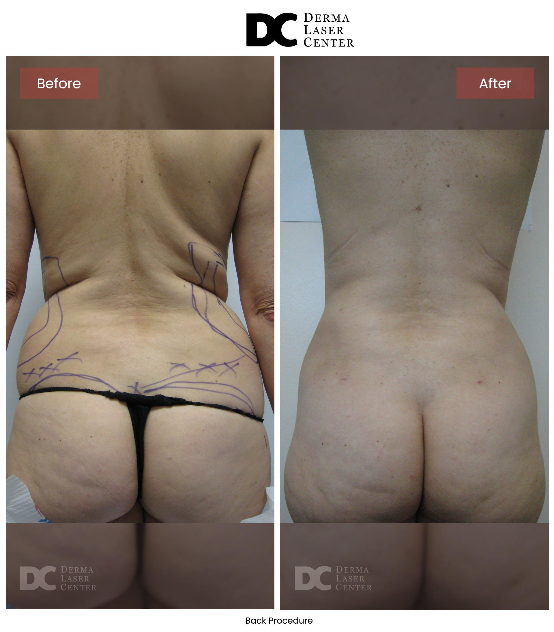 B&A Back Image 14 V1