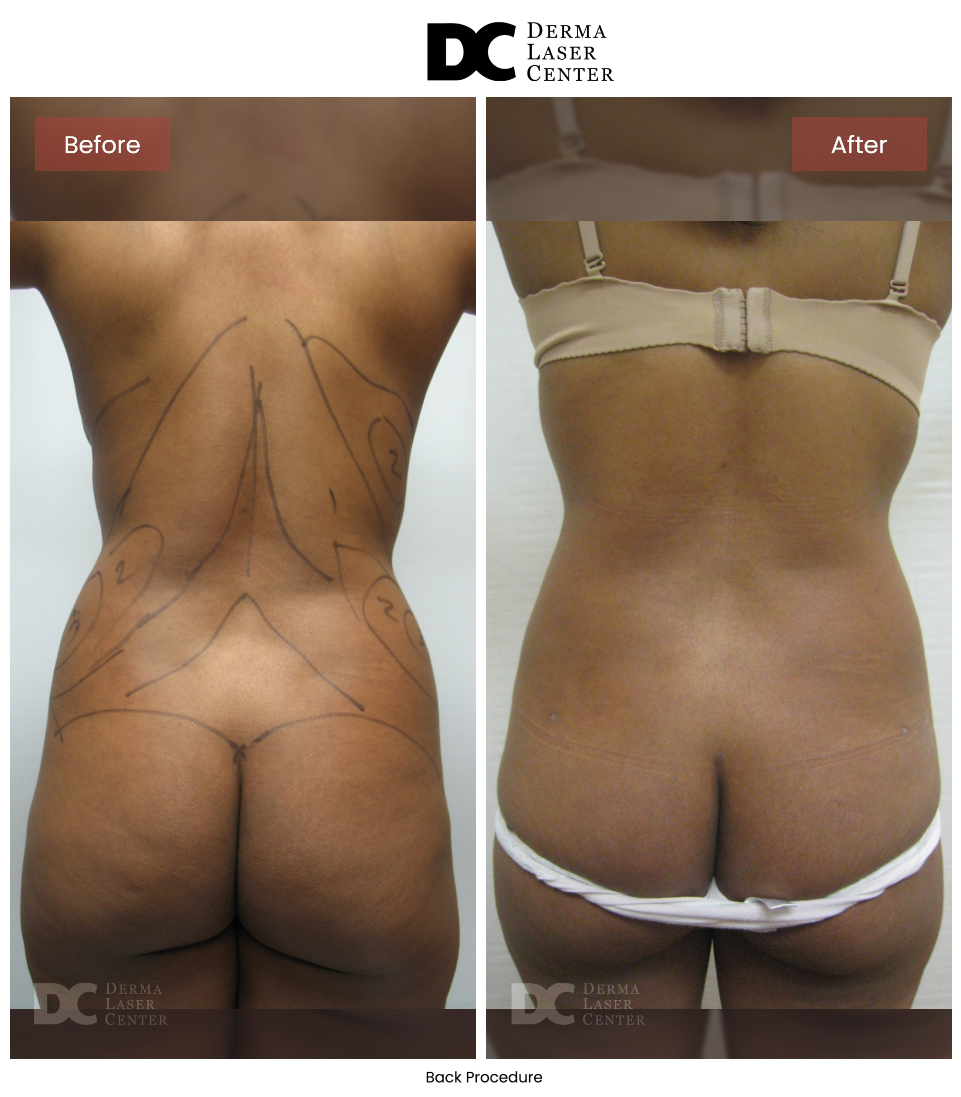 B&A Back Image 15 V1