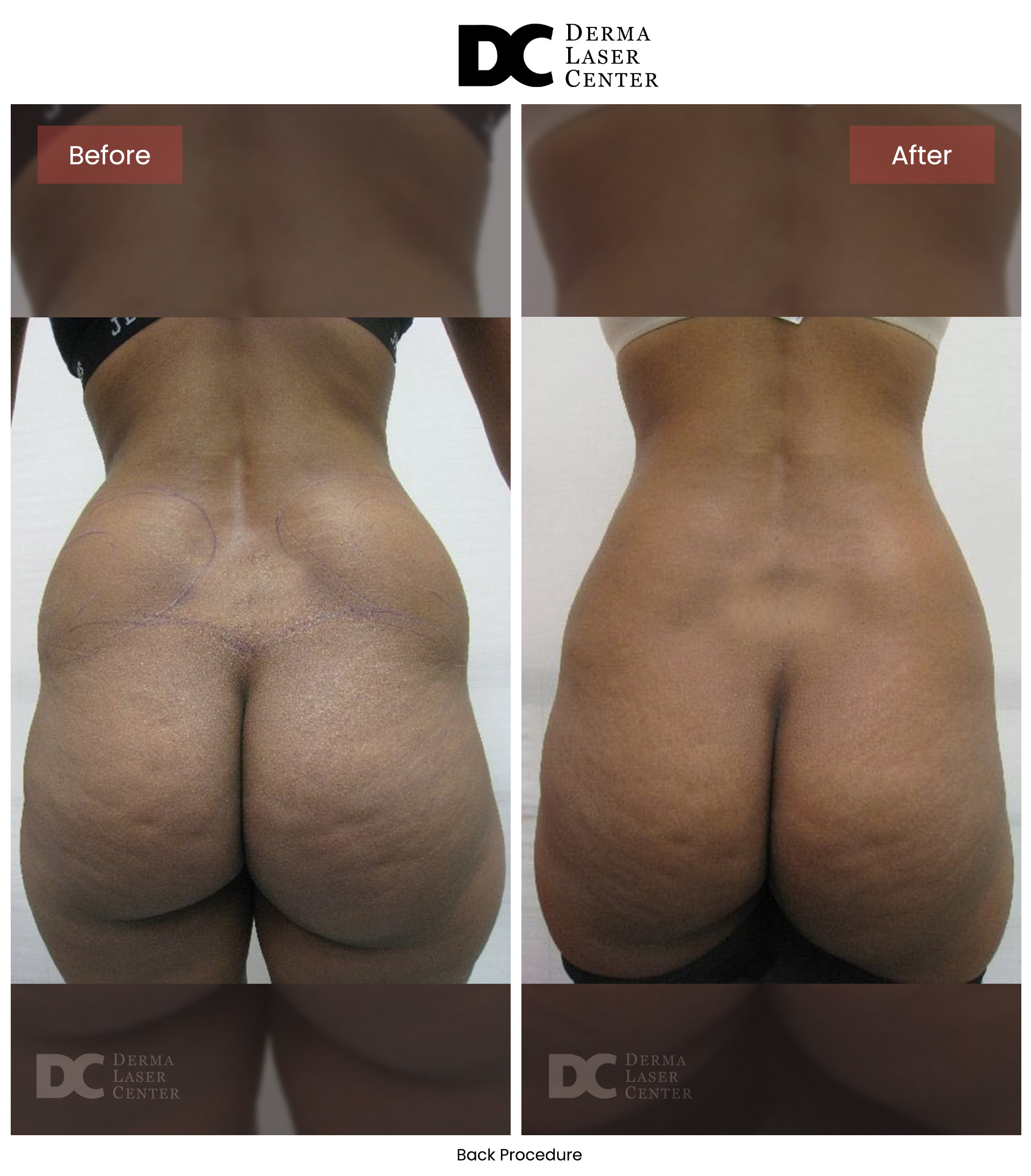 B&A Back Image 16 V1