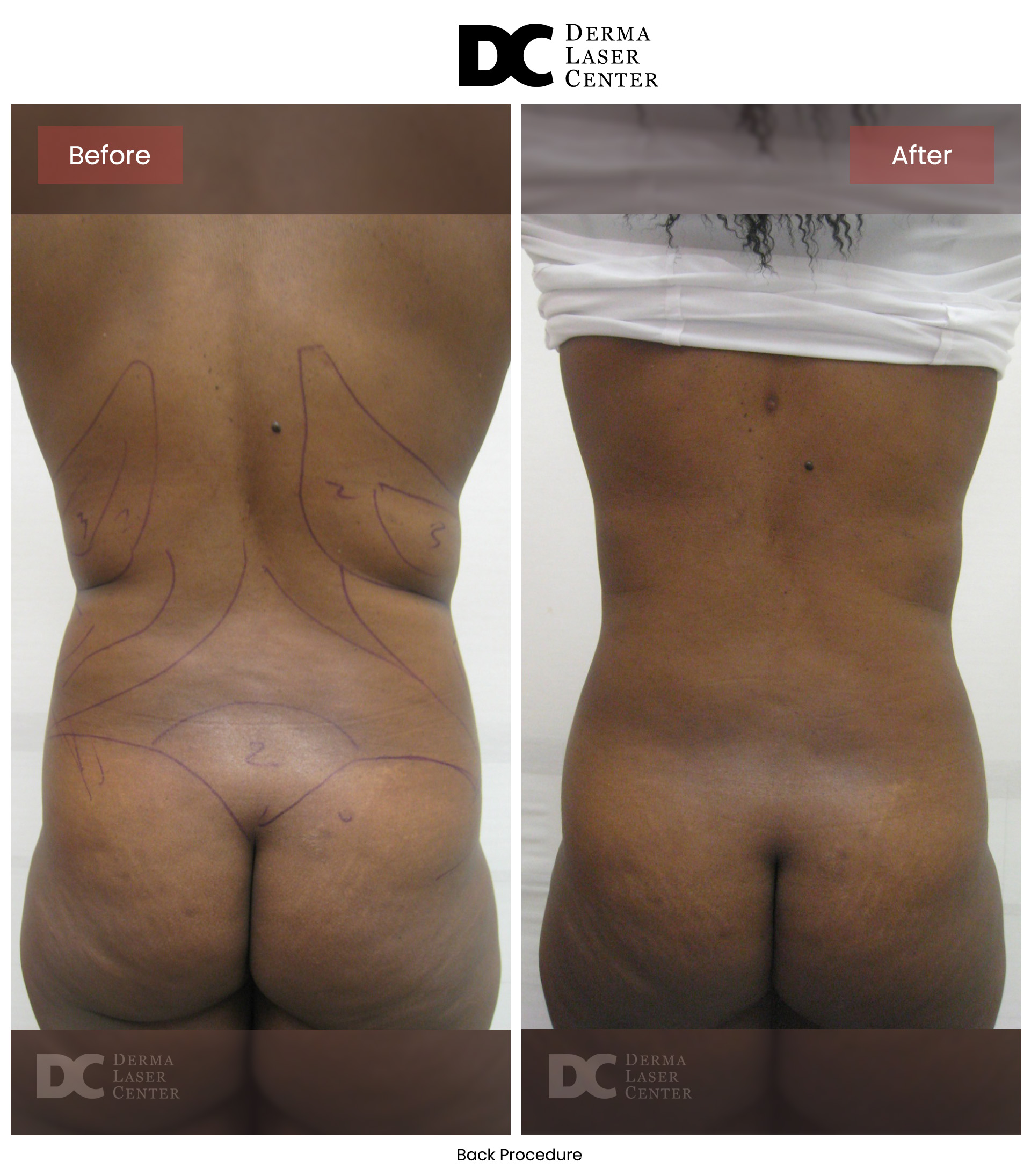 B&A Back Image 17 V1