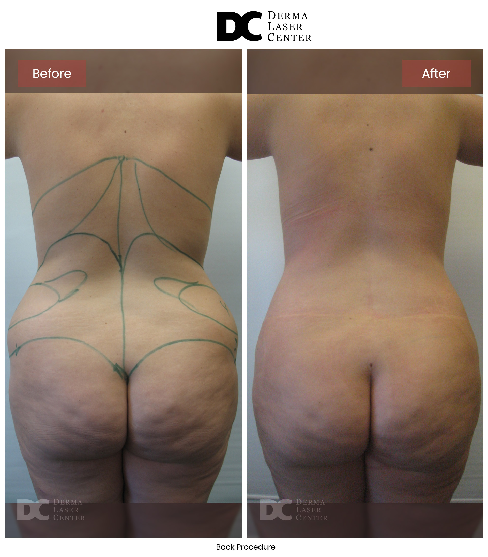 B&A Back Image 18 V1