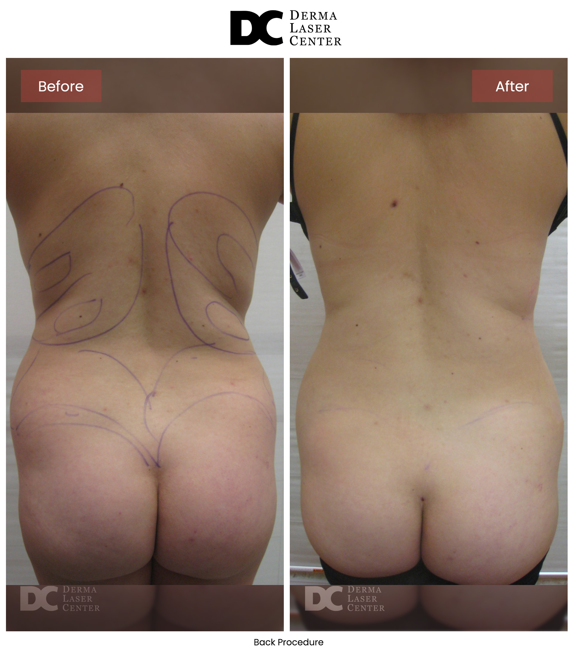 B&A Back Image 19 V1