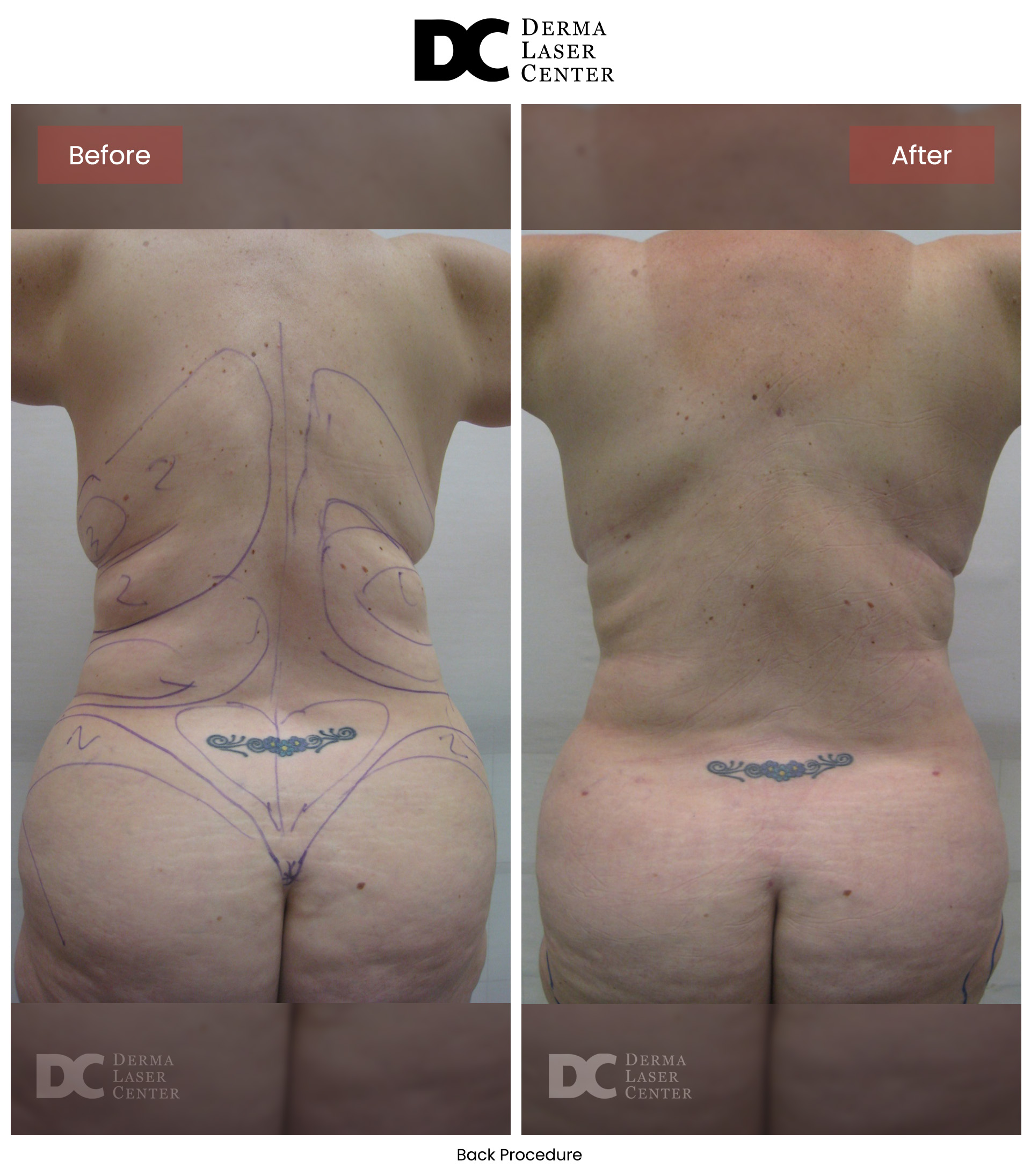 B&A Back Image 20 V1