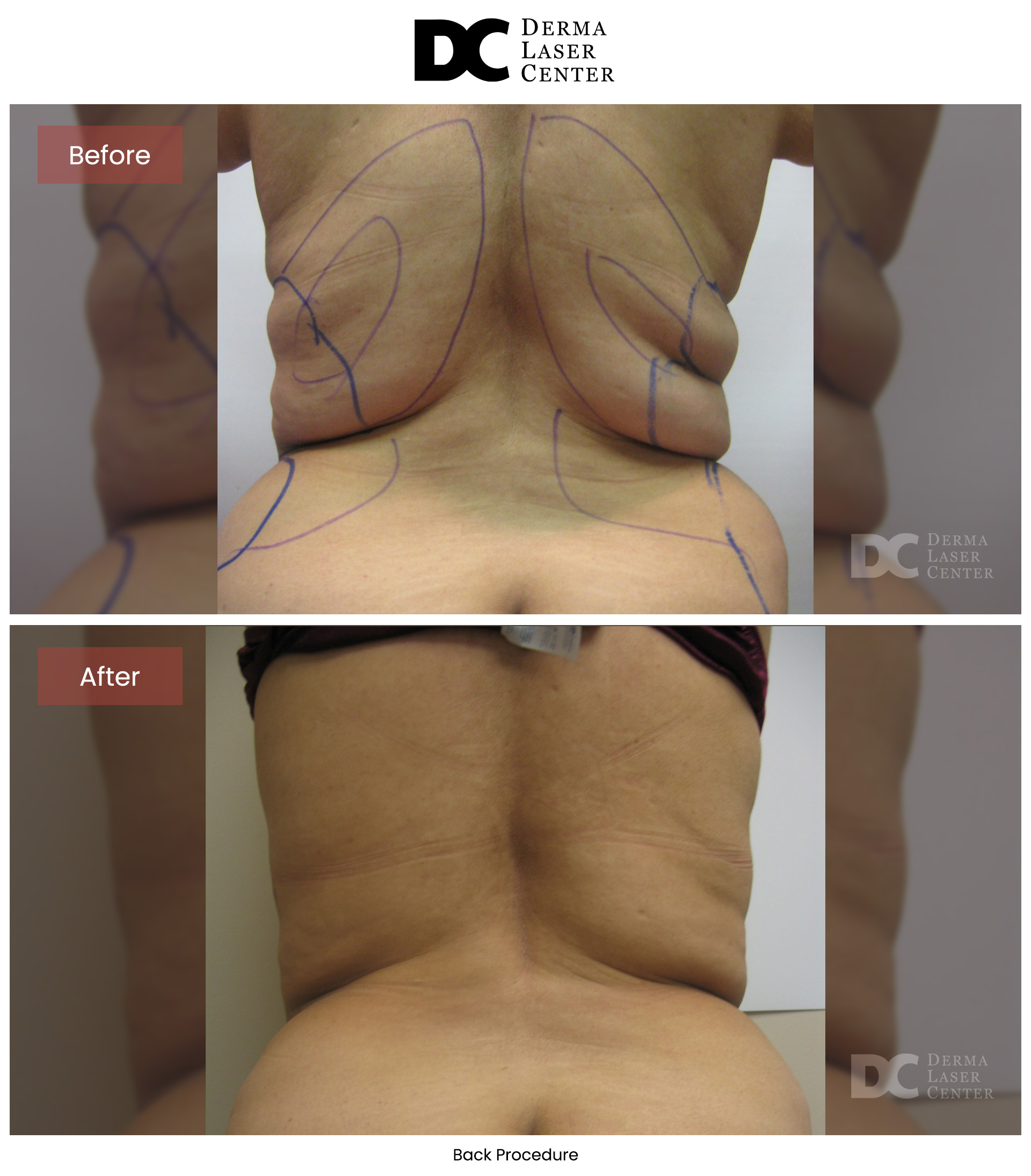 B&A Back Image 21 V1