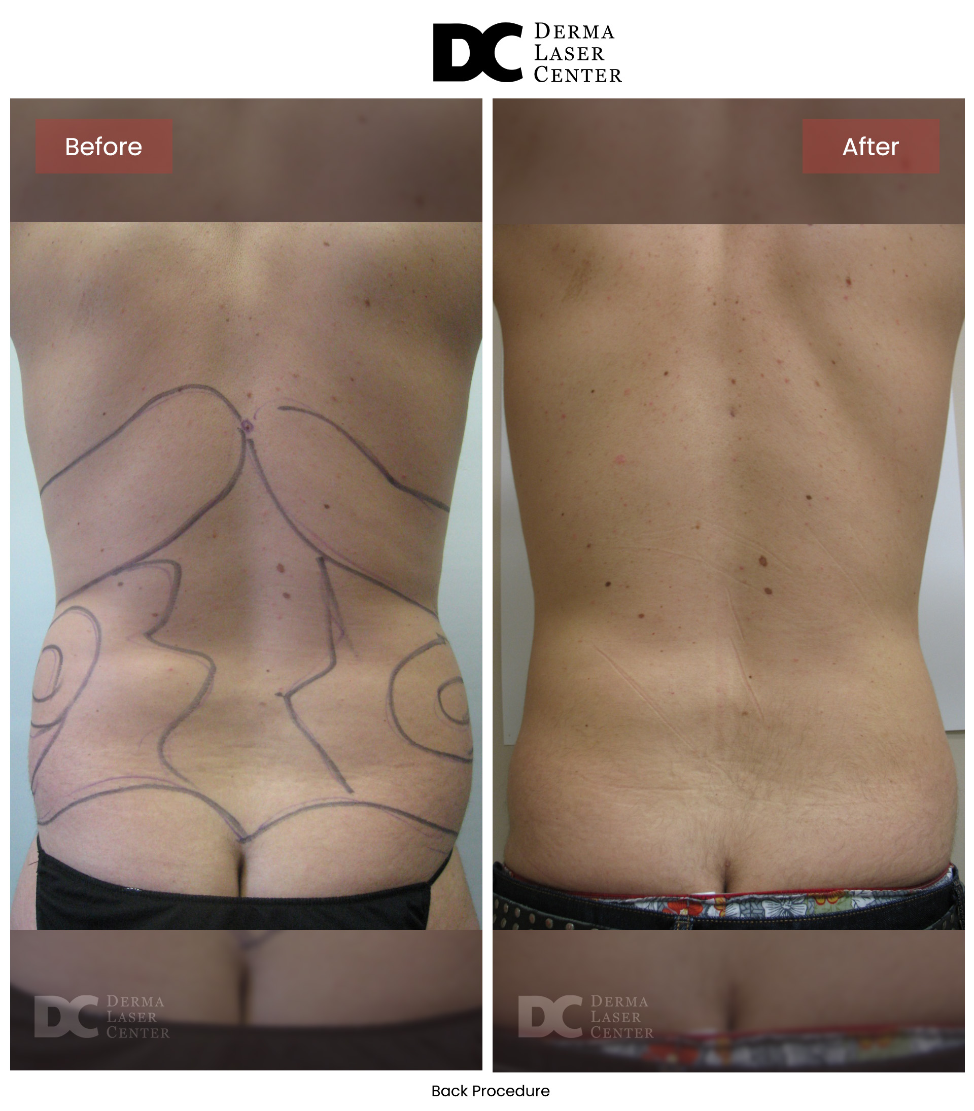 B&A Back Image 22 V1