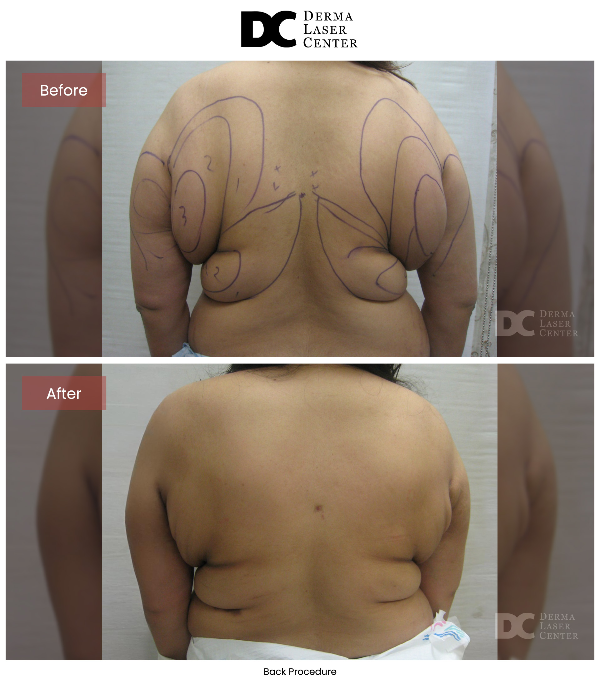 B&A Back Image 23 V1