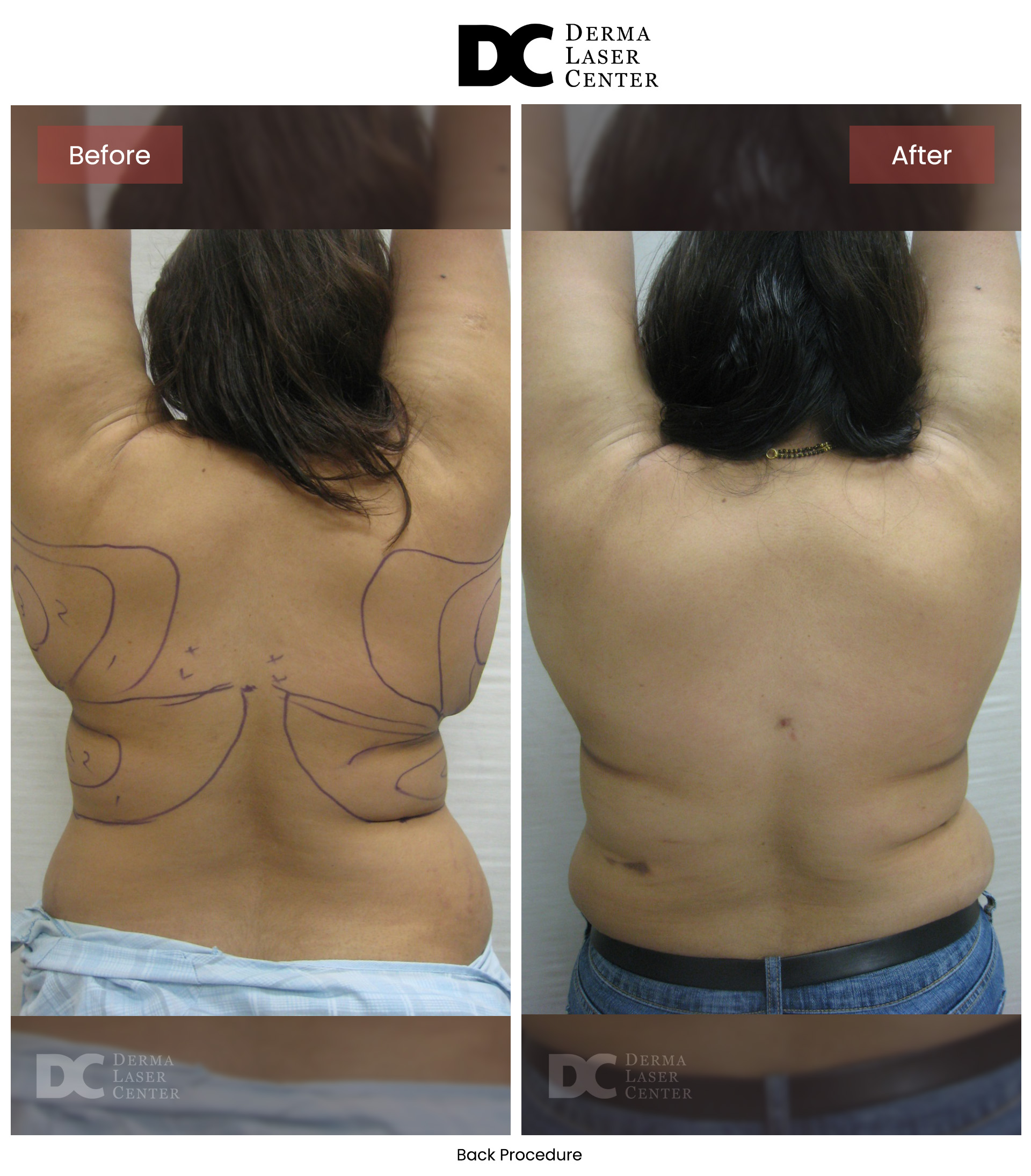 B&A Back Image 24 V1