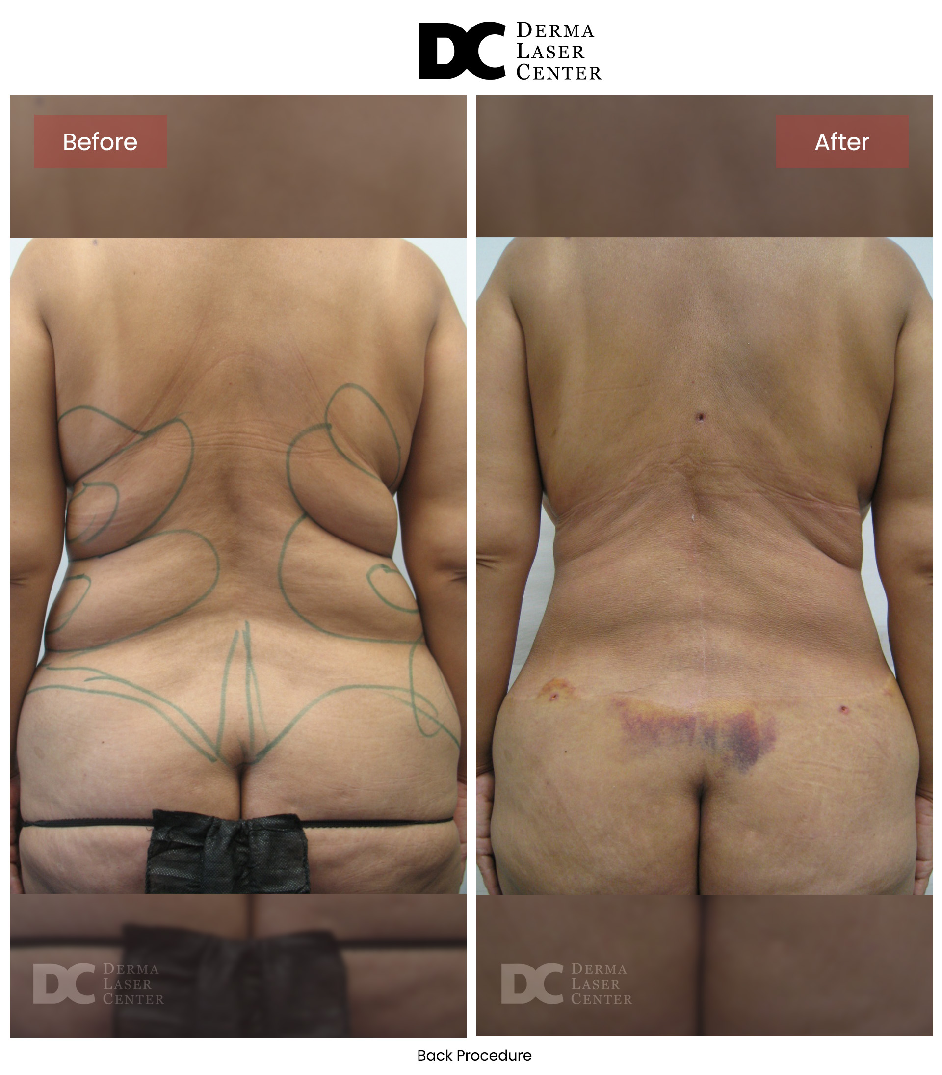 B&A Back Image 25 V1