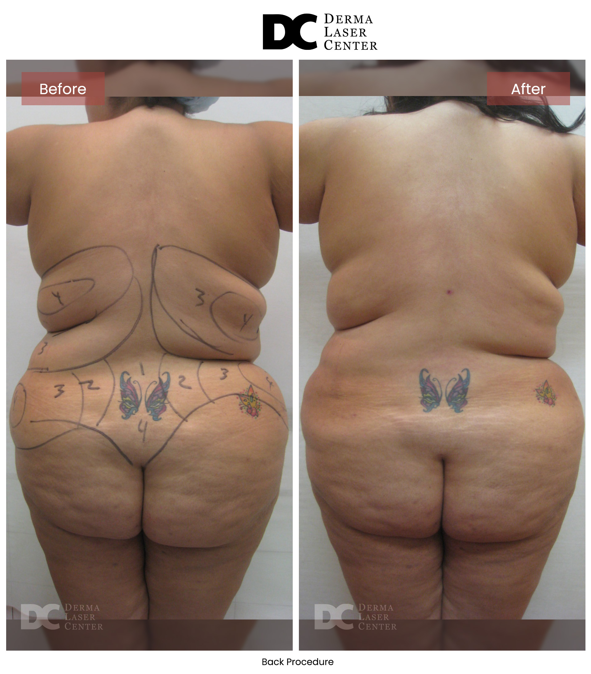 B&A Back Image 26 V1