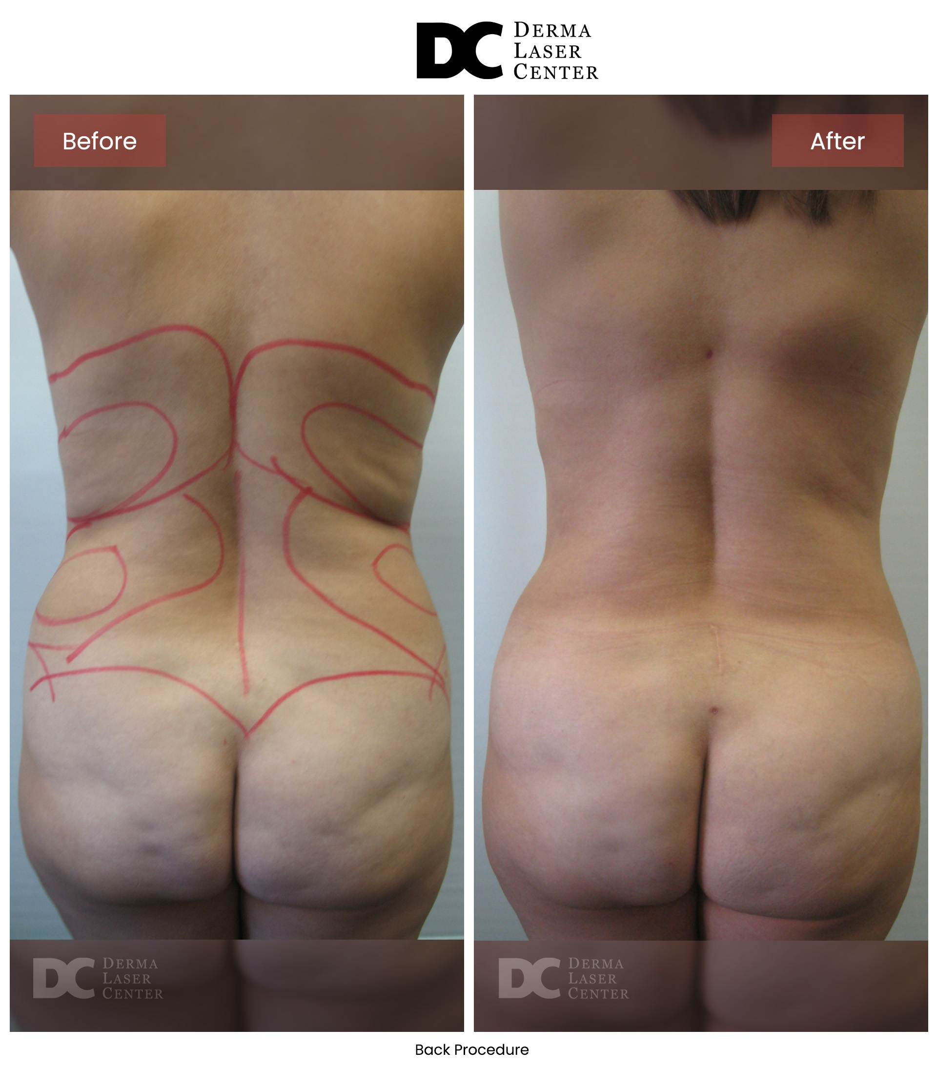 B&A Back Image 27 V1