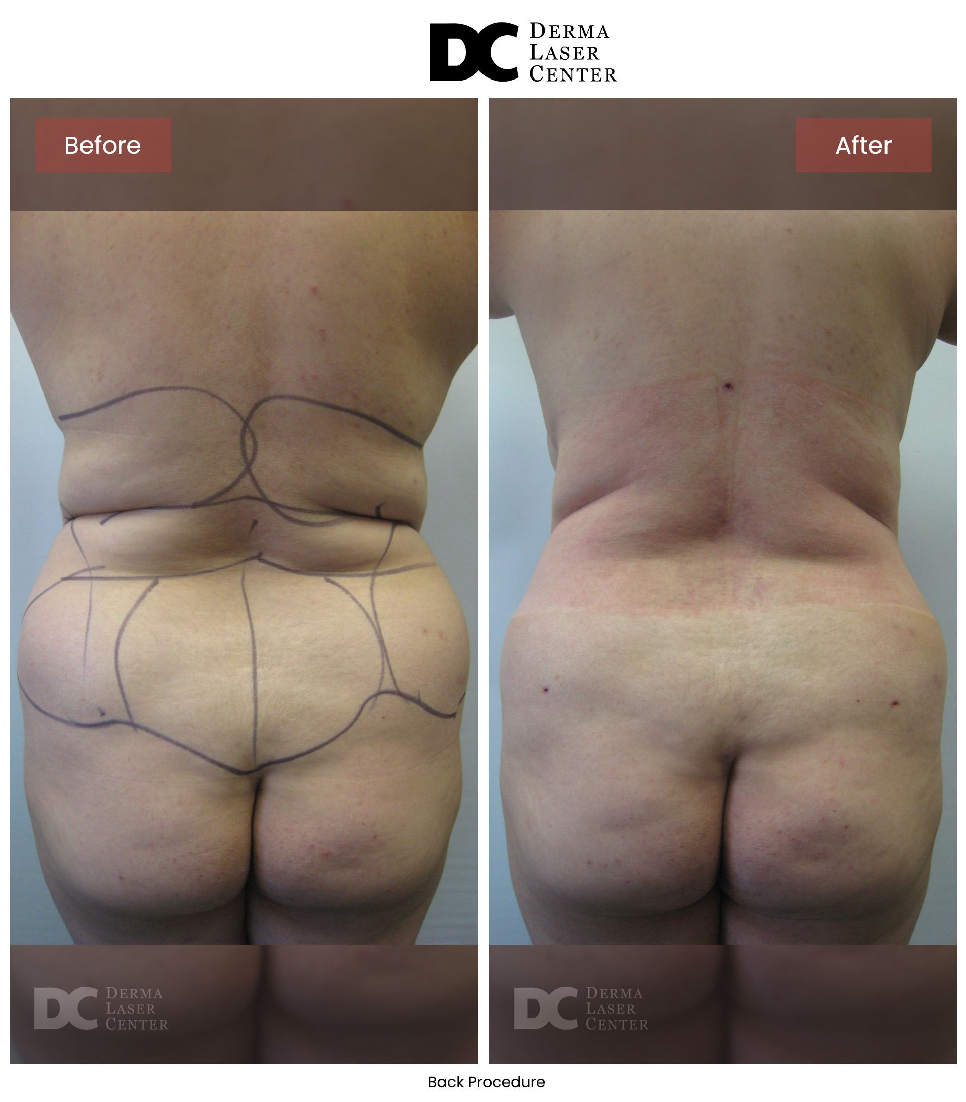 B&A Back Image 28 V1