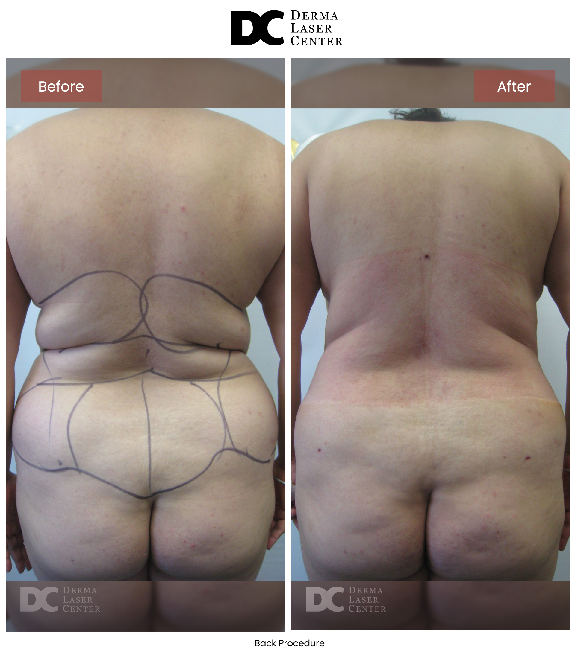 B&A Back Image 29 V1