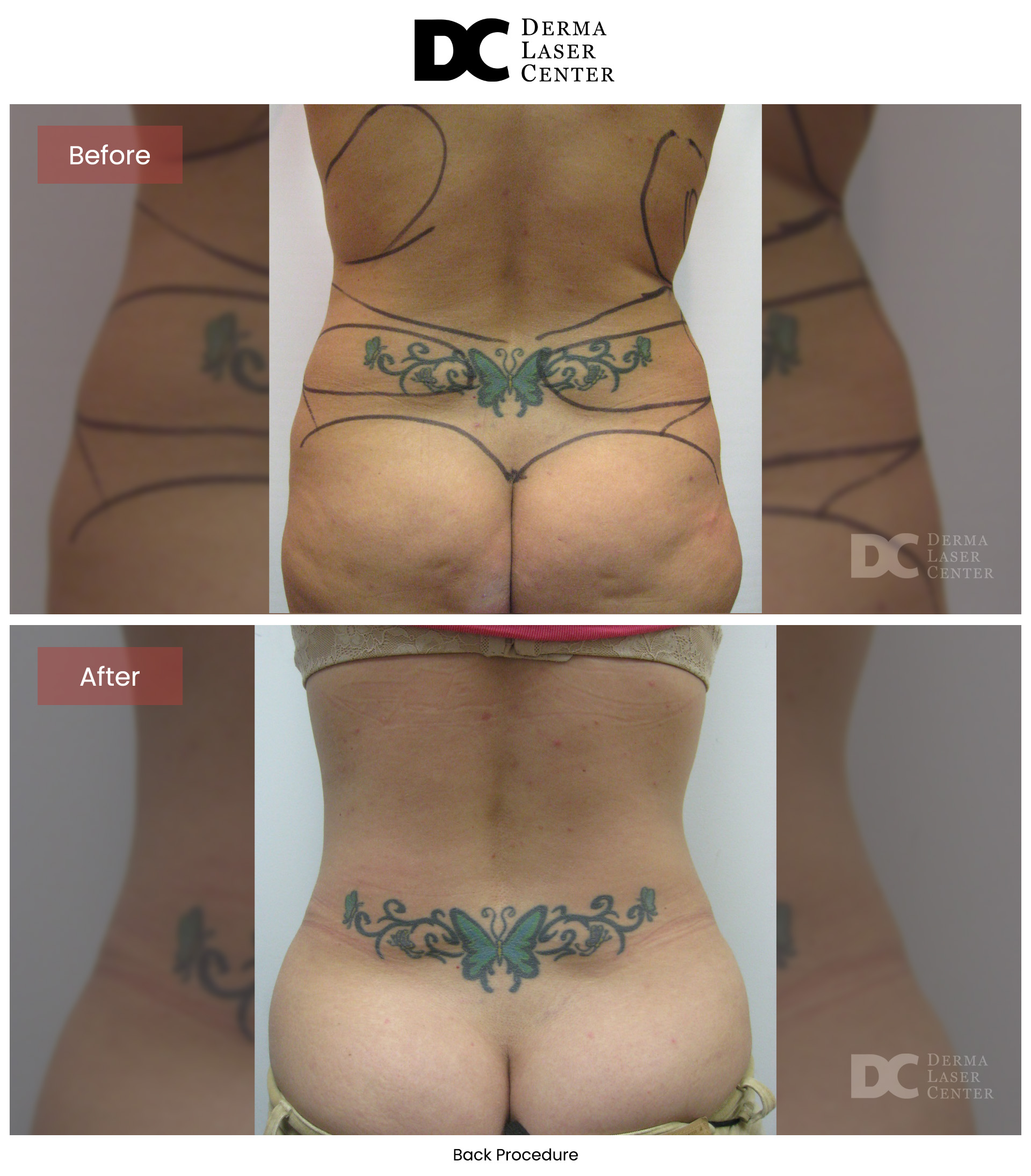 B&A Back Image 30 V1