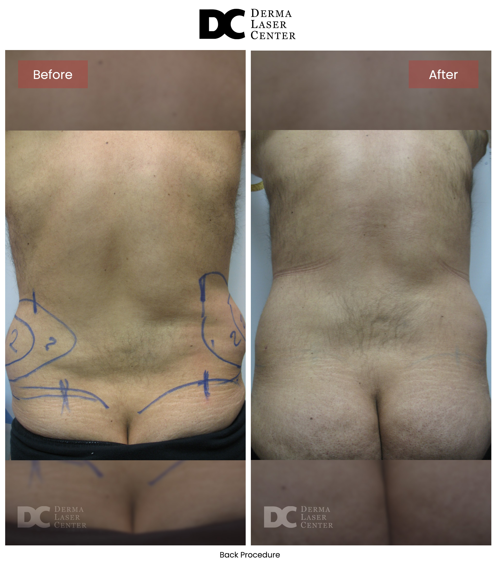 B&A Back Image 31 V1