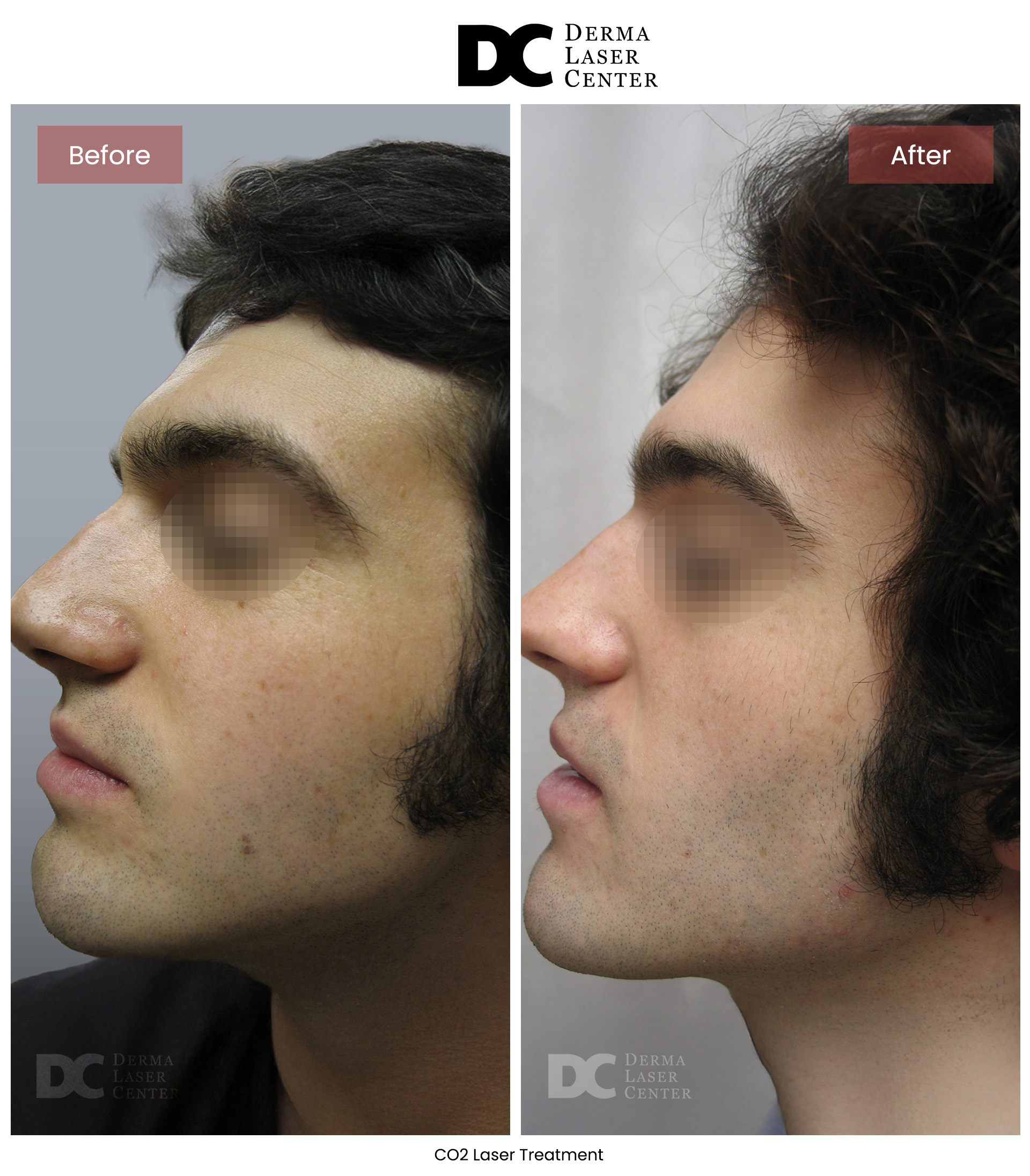 B&A CO2 Laser Image 03 V1