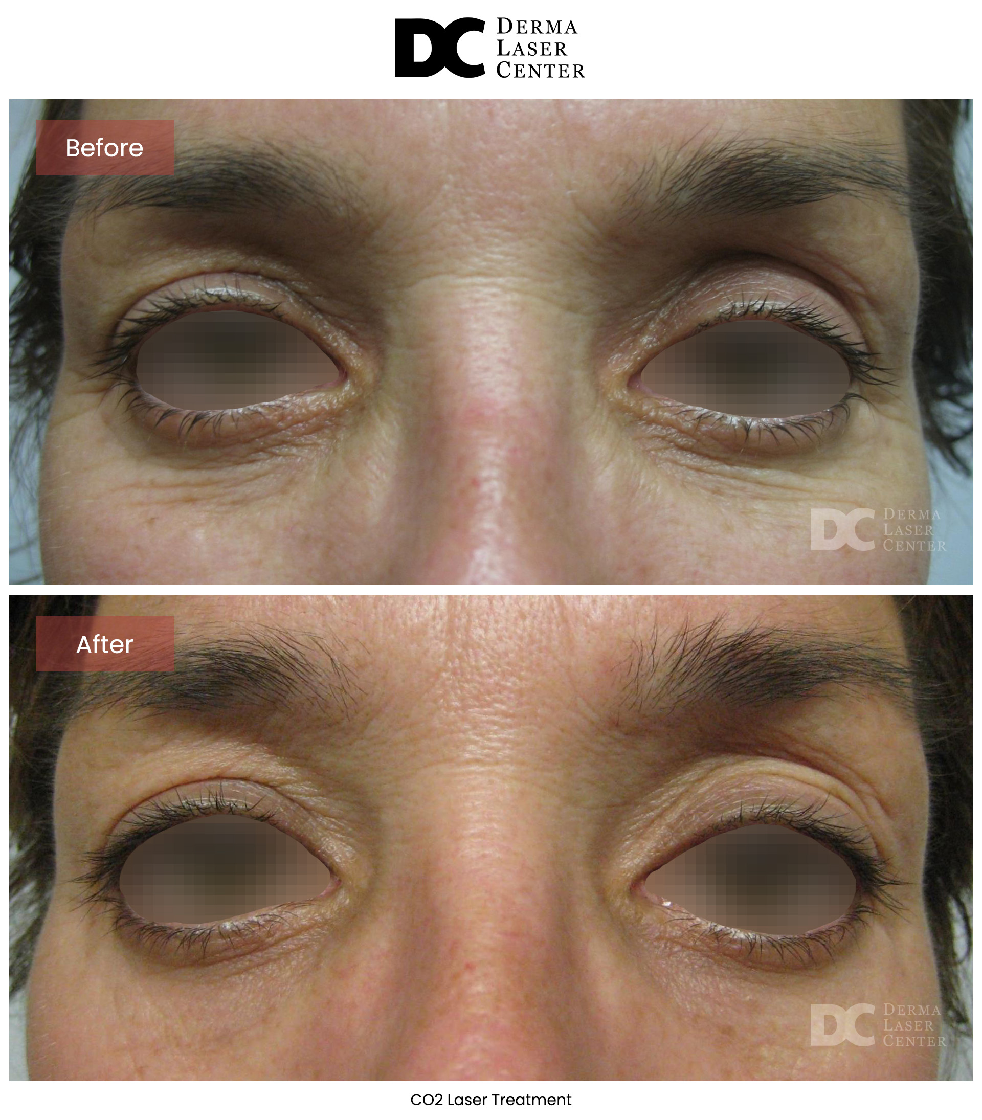 B&A CO2 Laser Image 10 V1