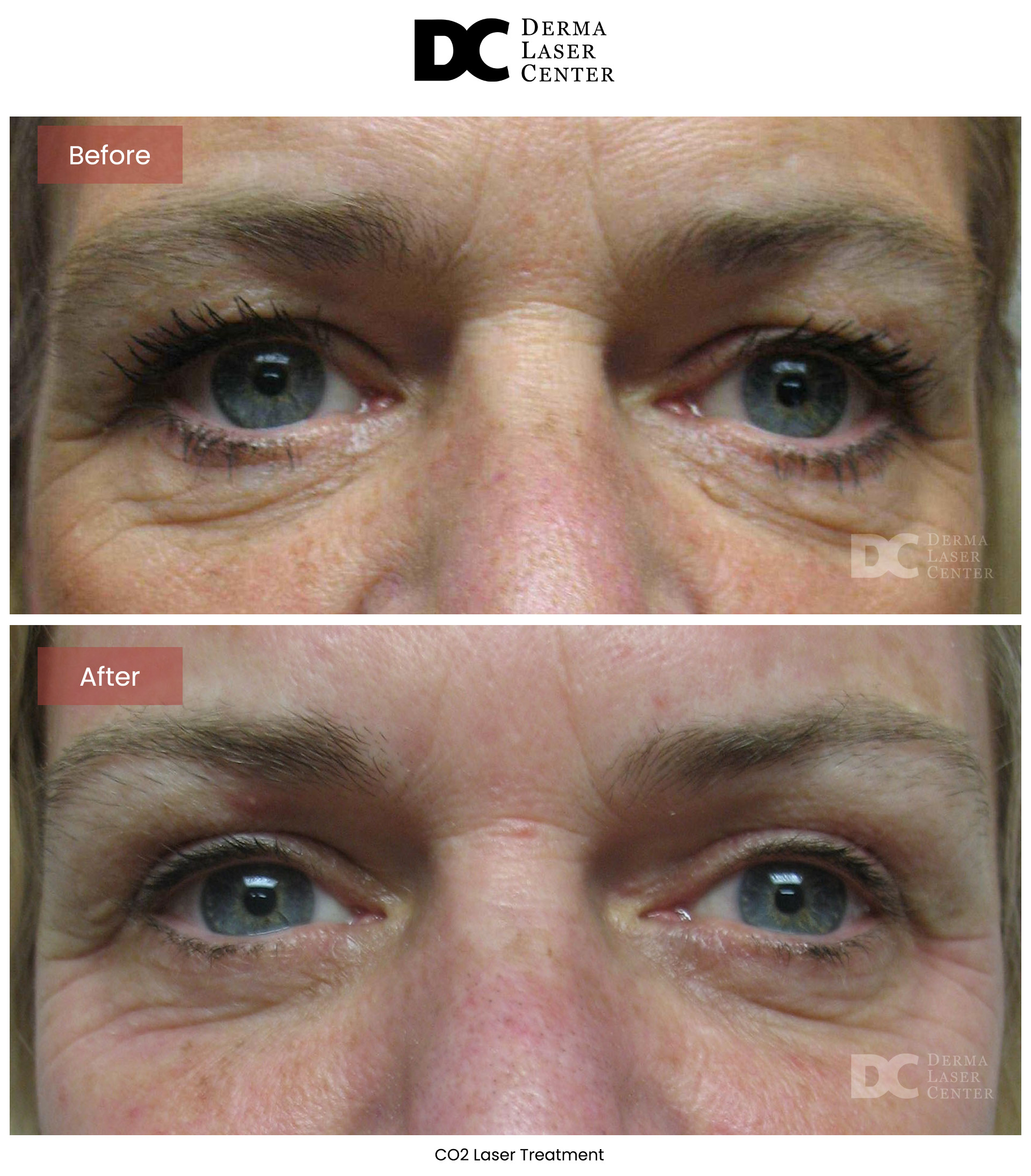 B&A CO2 Laser Image 11 V1