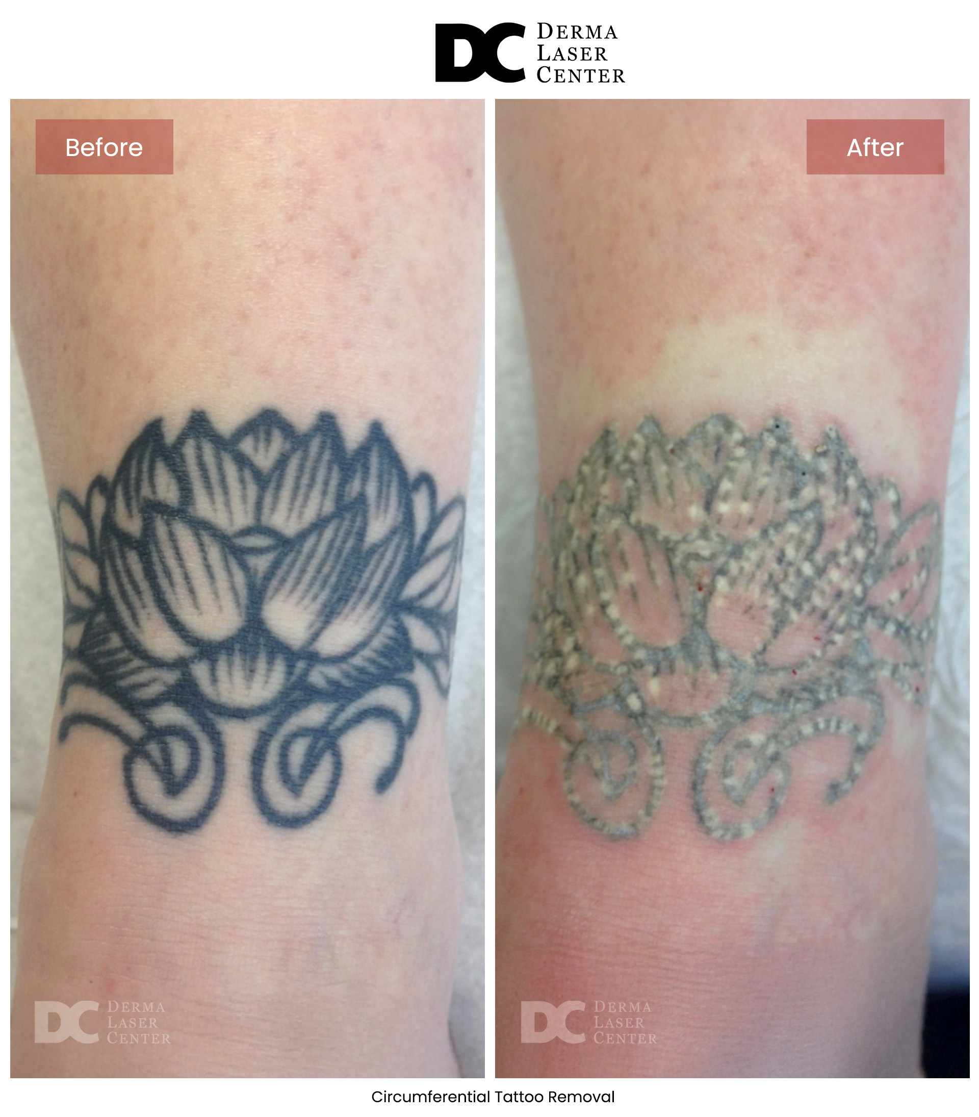B&A CO2 Laser Image 13 V1