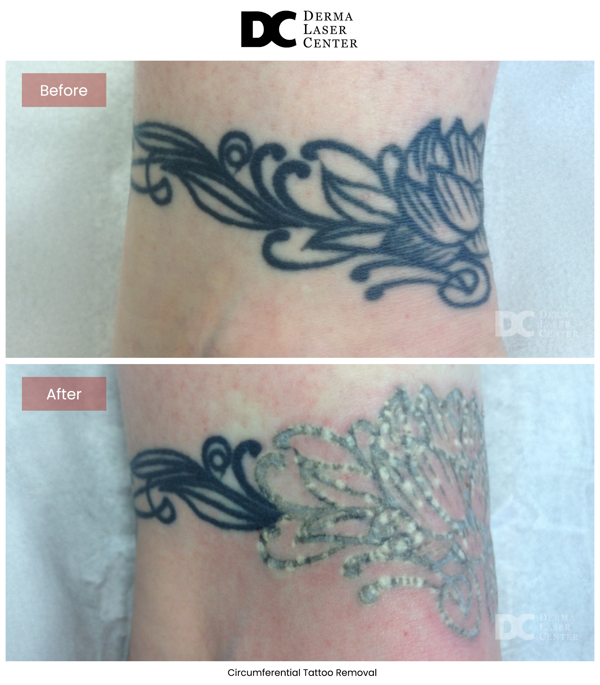 B&A CO2 Laser Image 14 V1