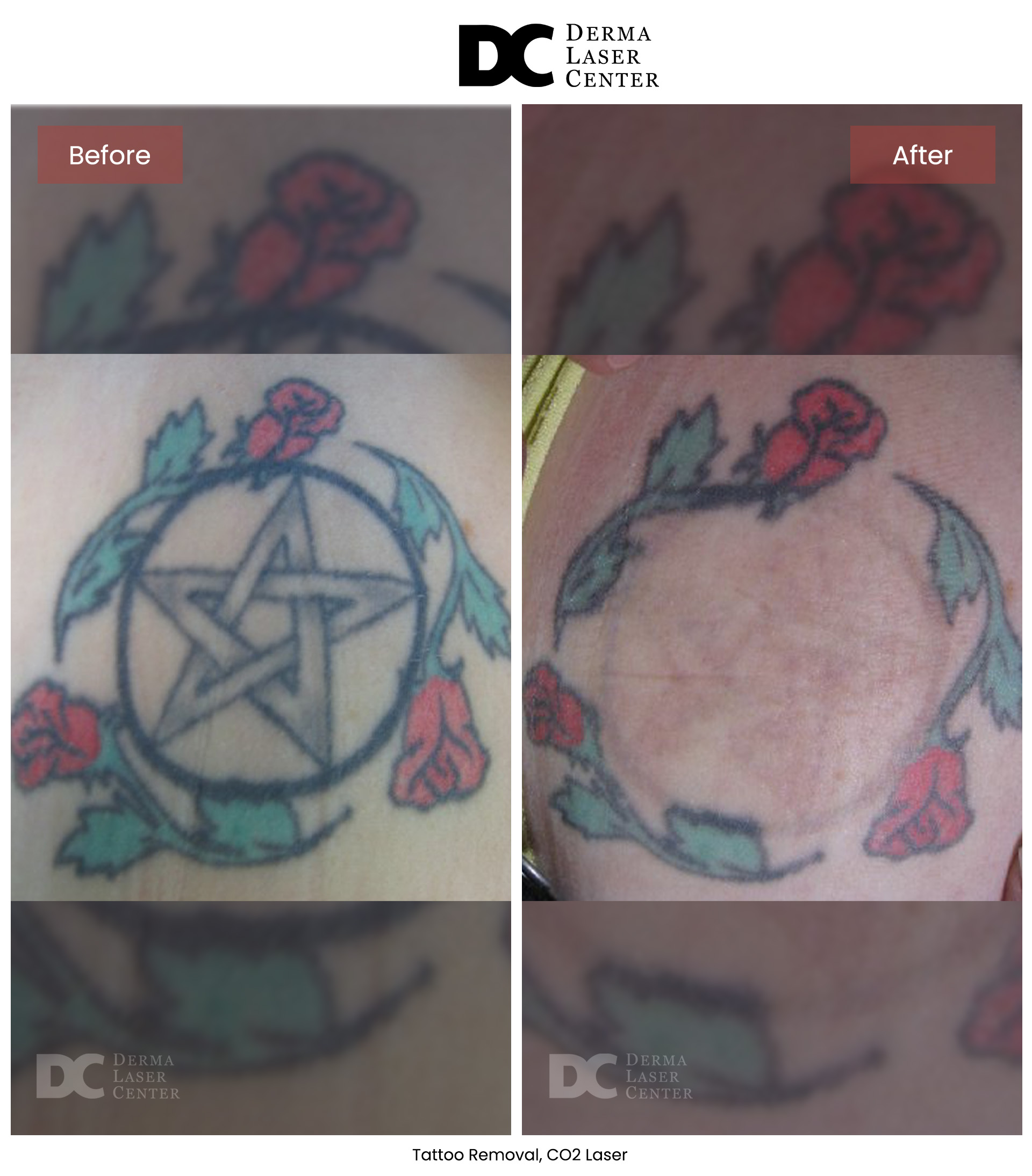 B&A CO2 Laser Image 17 V1