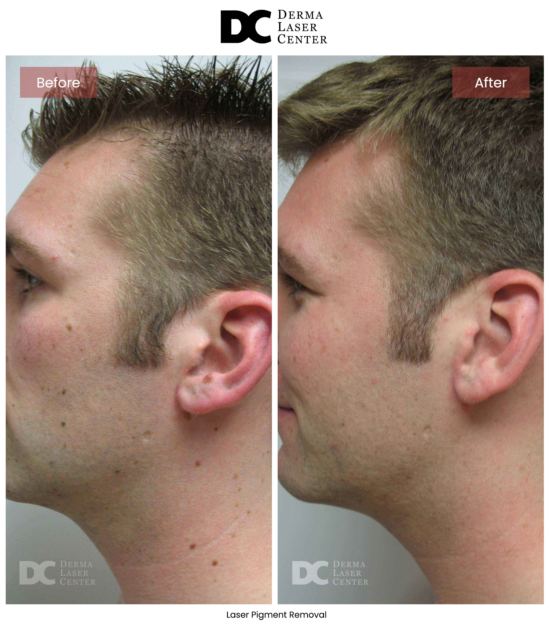 B&A Laser Image 06 V1