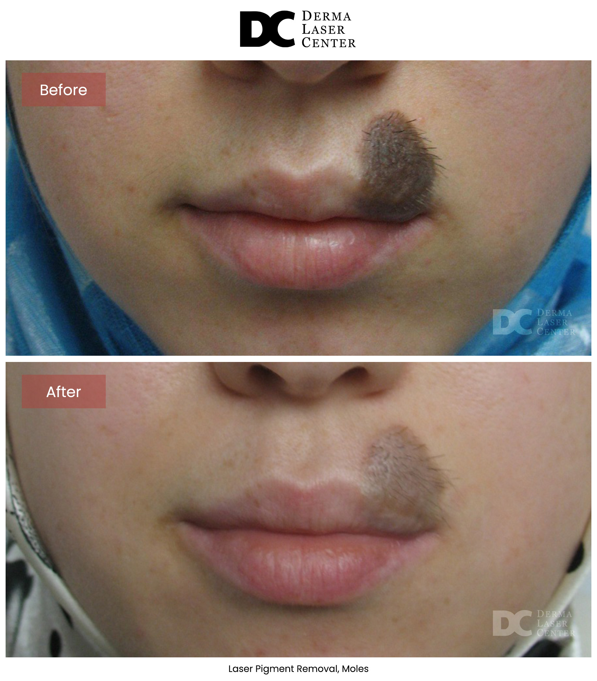 B&A Laser Image 08 V1