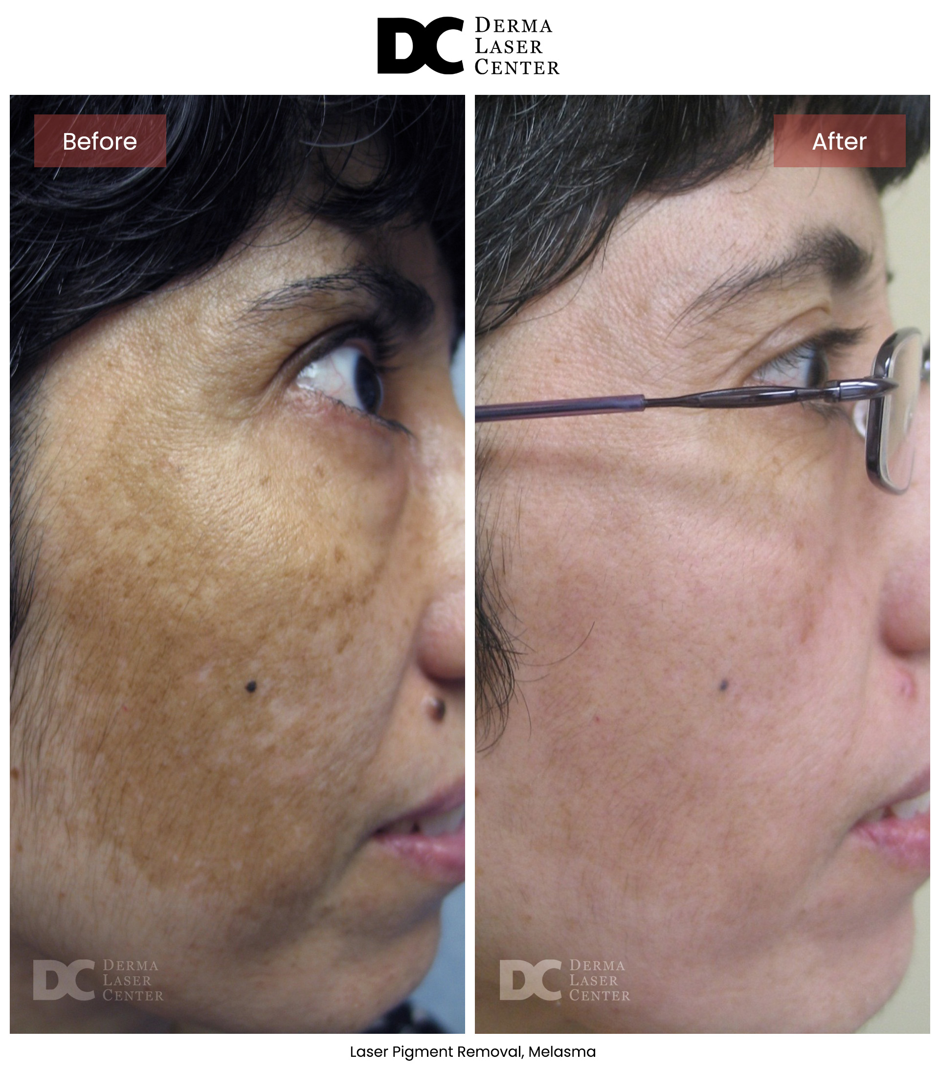 B&A Laser Image 09 V1