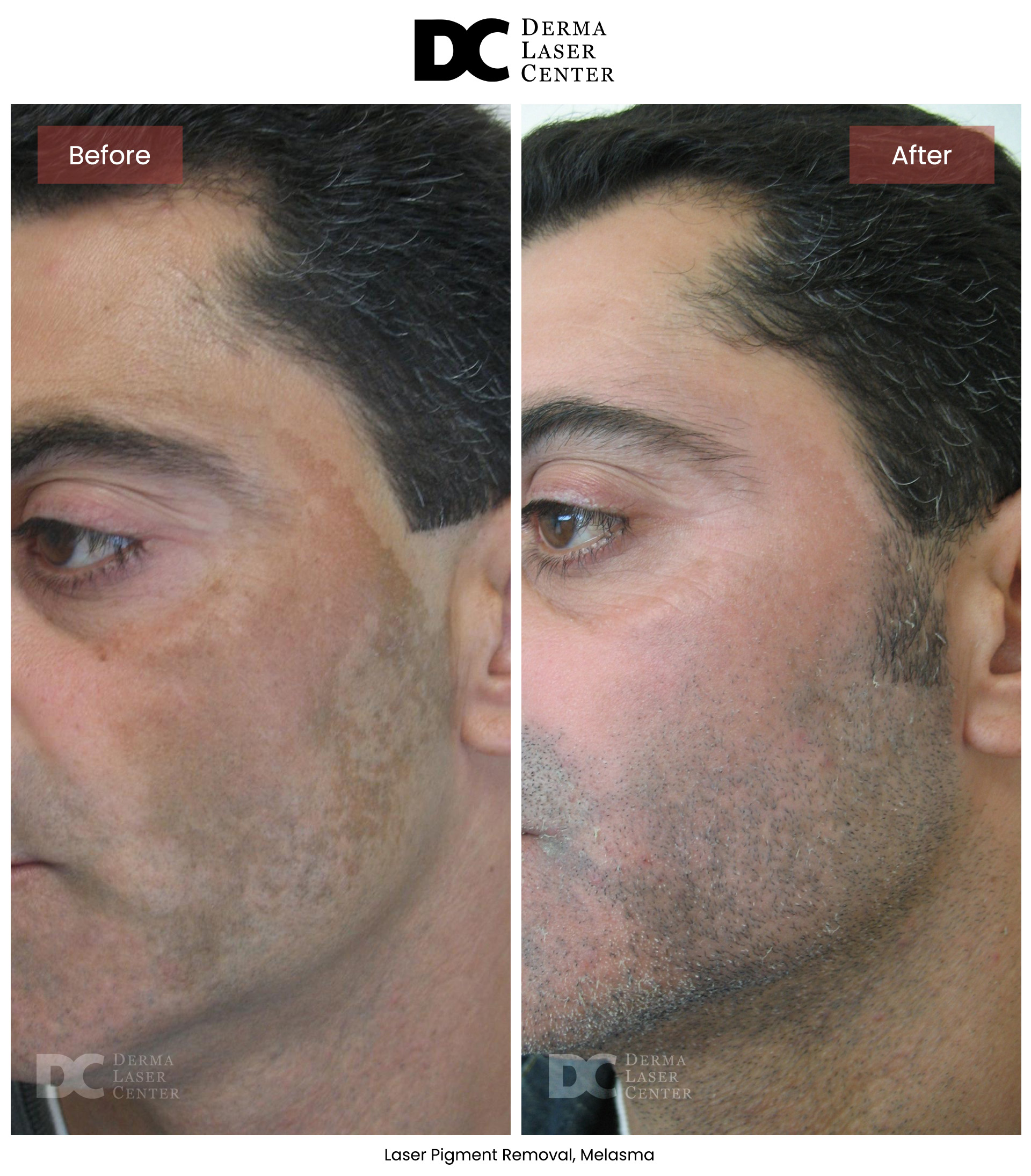 B&A Laser Image 10 V1