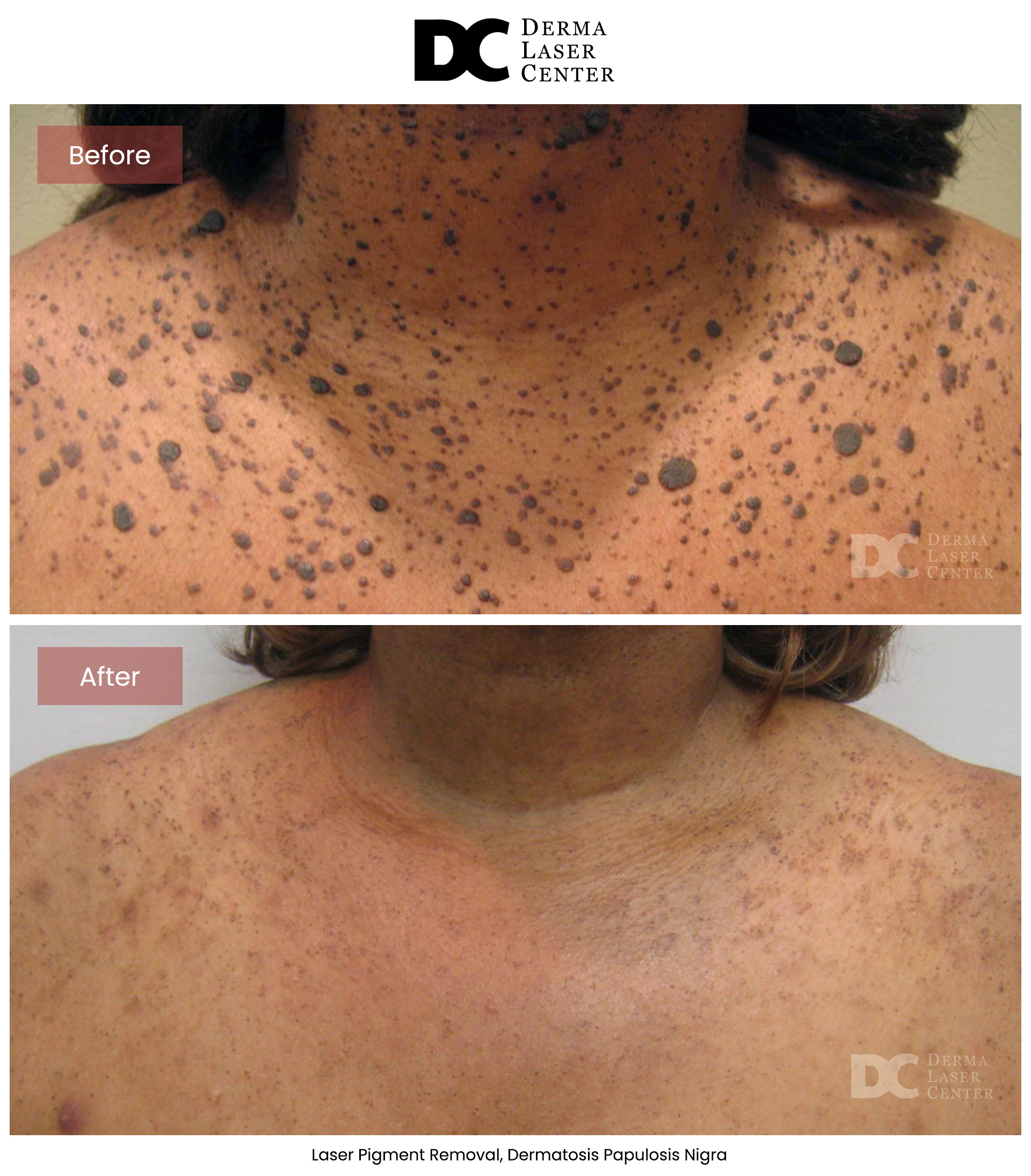 B&A Laser Image 11 V1