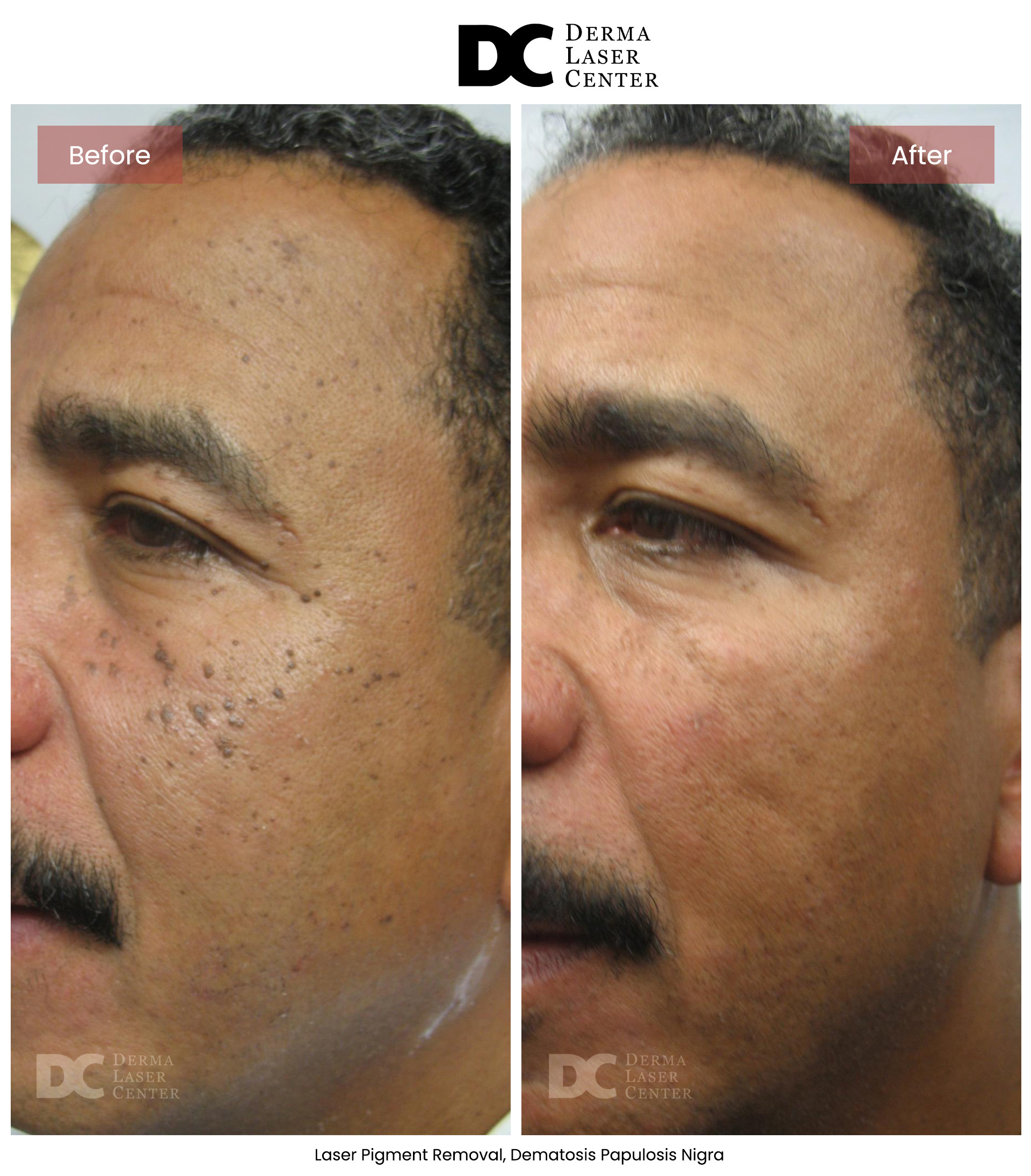 B&A Laser Image 13 V1