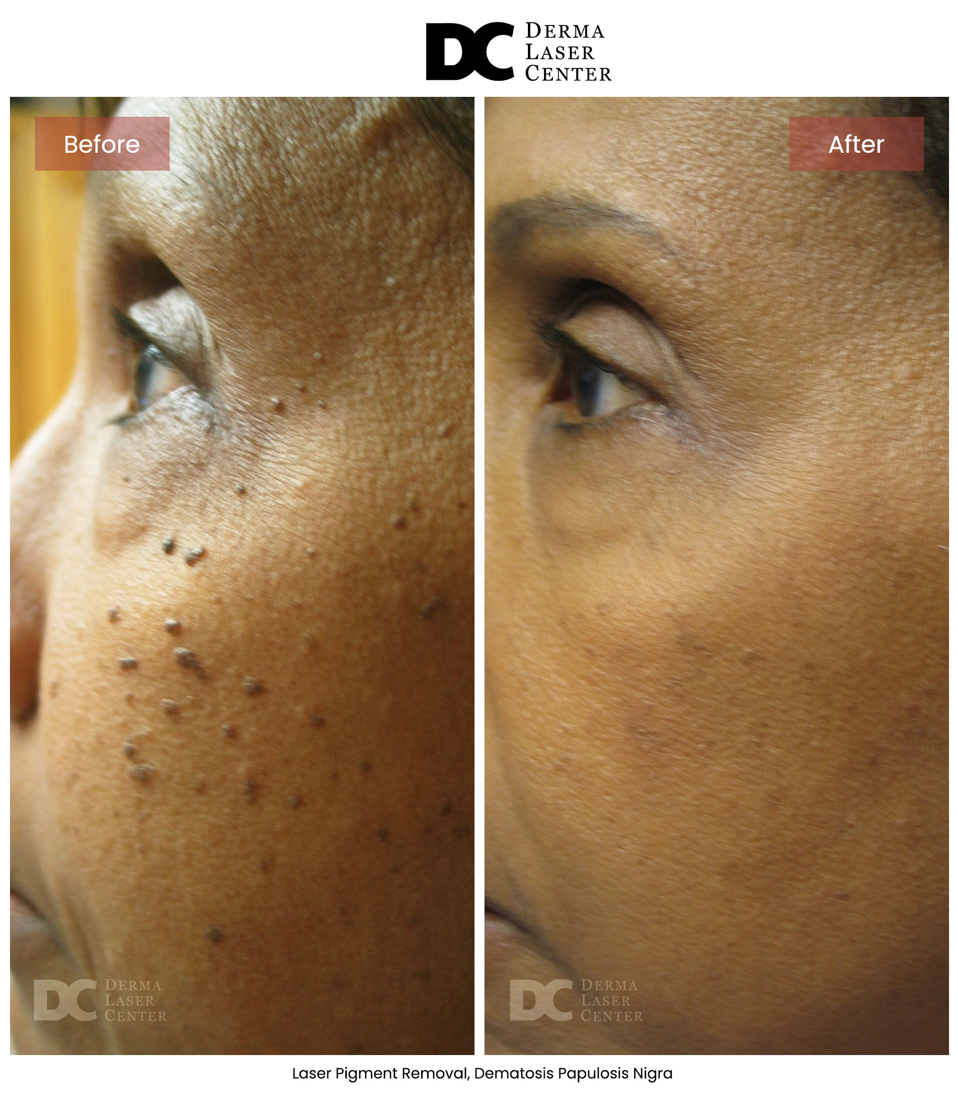 B&A Laser Image 14 V1