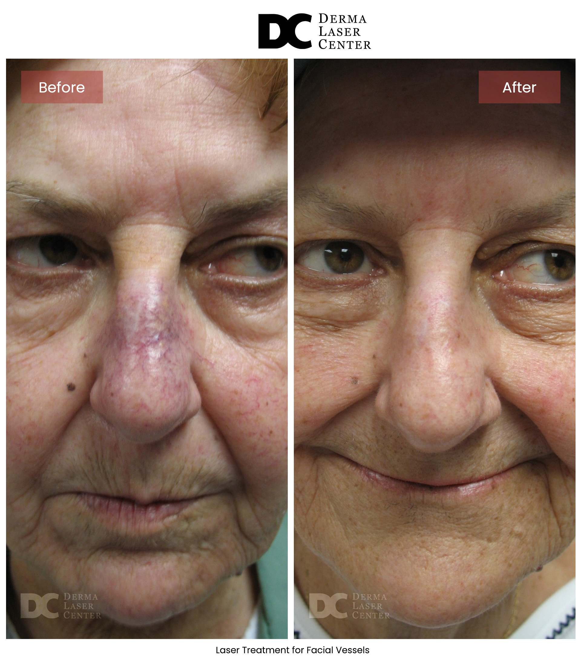 B&A Laser Image 17 V1