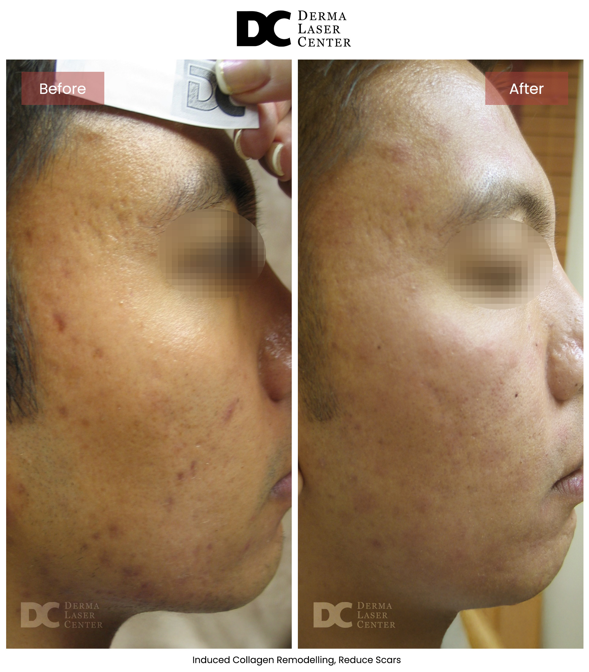 B&A Laser Image 26 V1