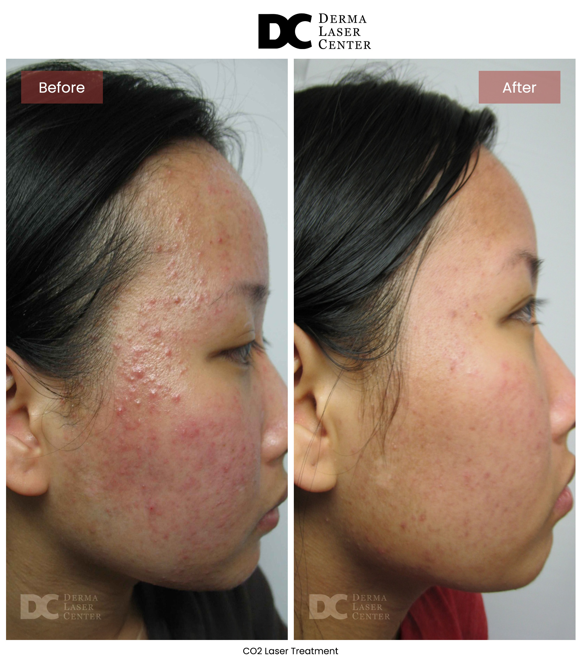 B&A Laser Image 27 V1