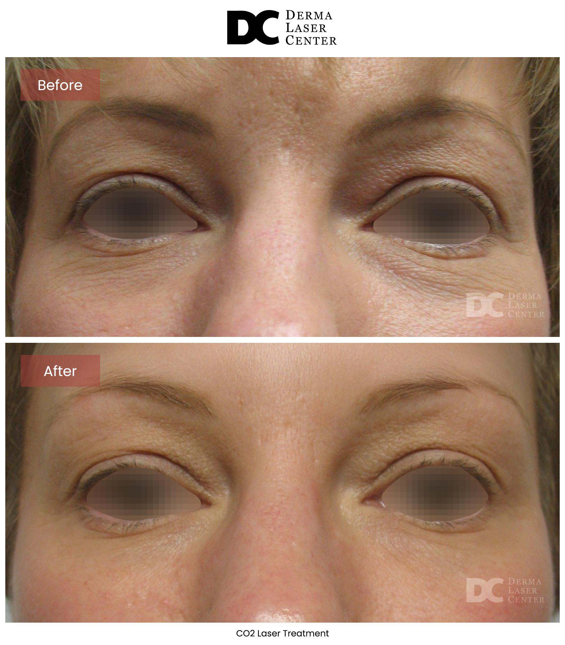 B&A Laser Image 28 V1