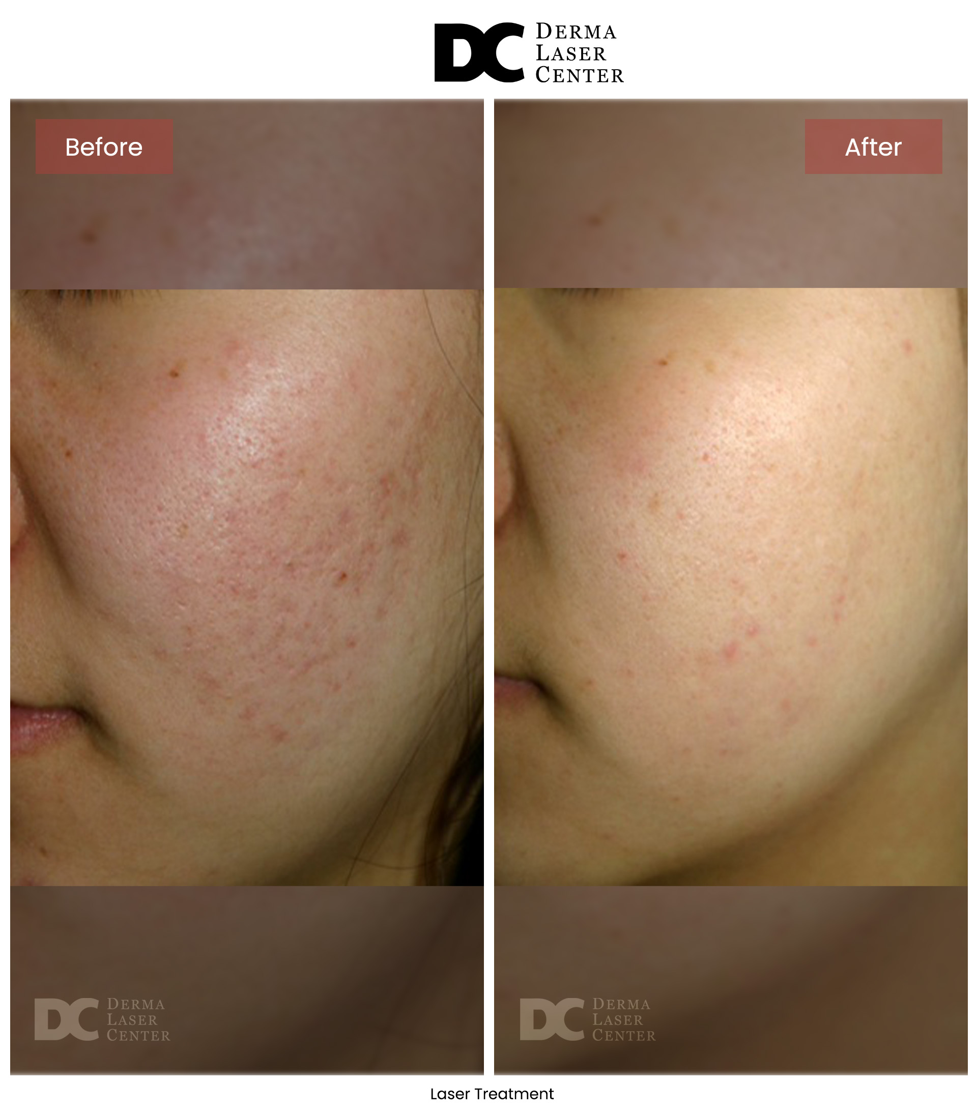 B&A Laser Image 31 V1