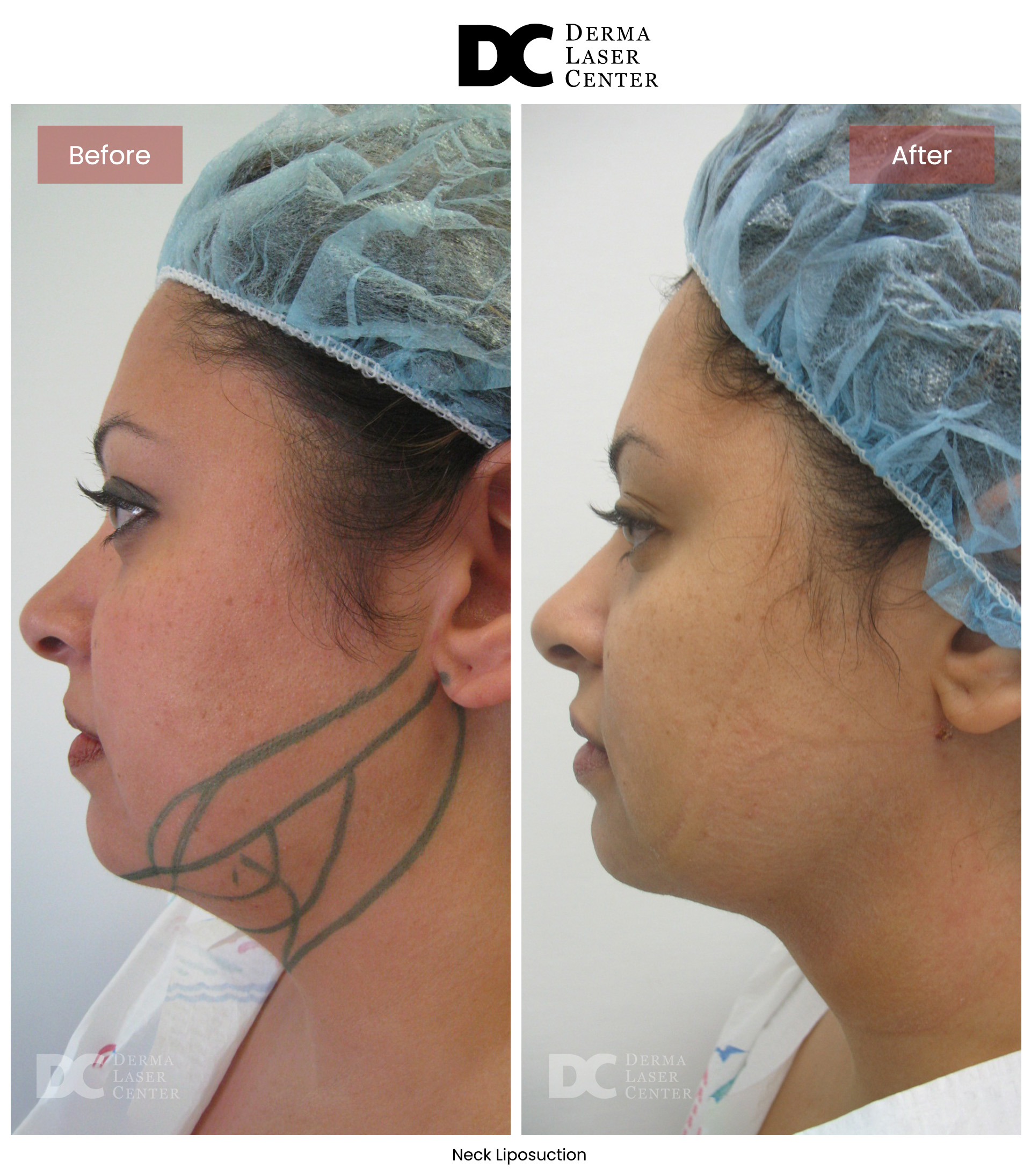 B&A Neck Image 01 V1